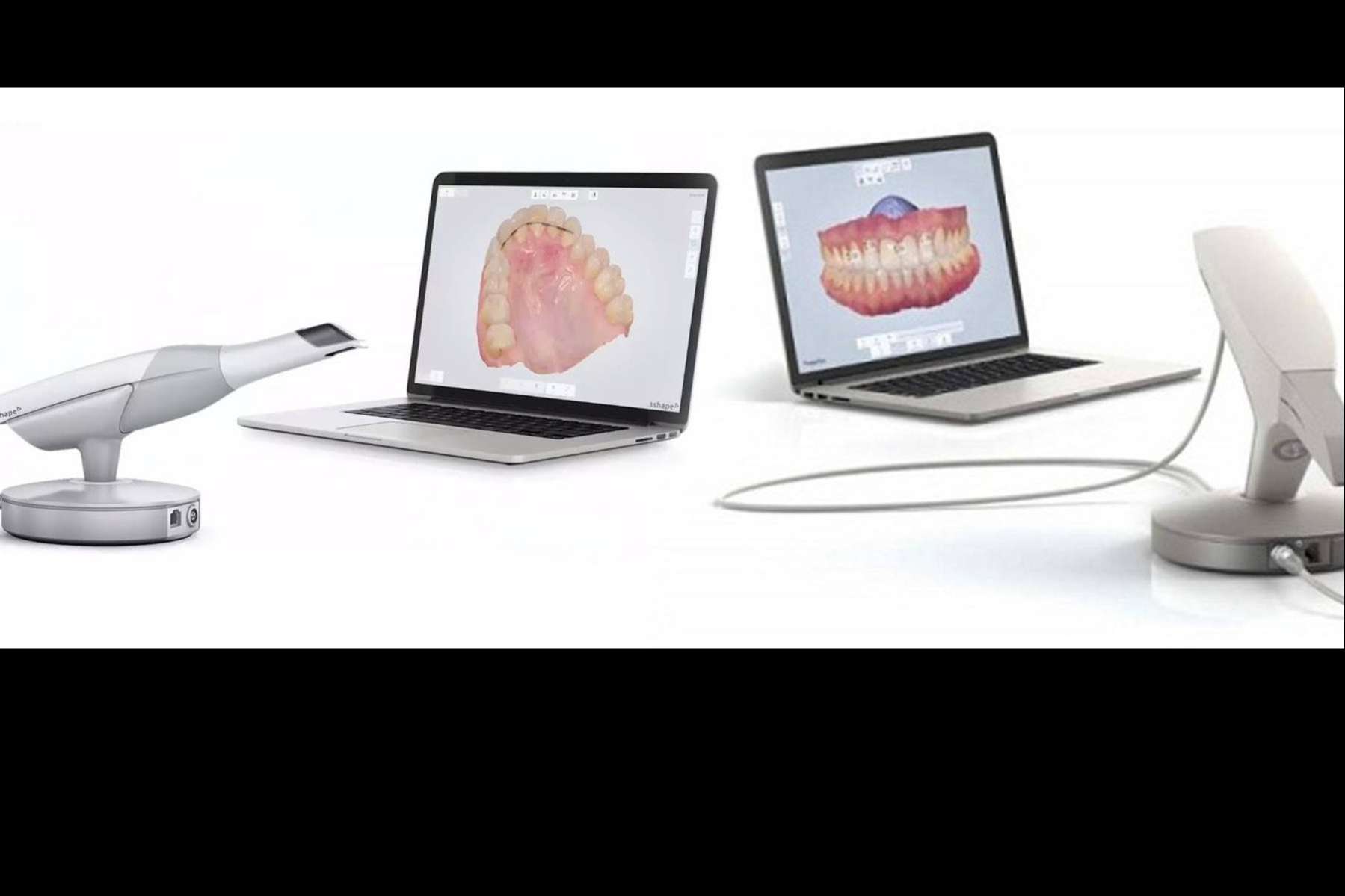 El escáner de última tecnología 3Shape TRIOS, disponible en la clínica dental Implant Clinics