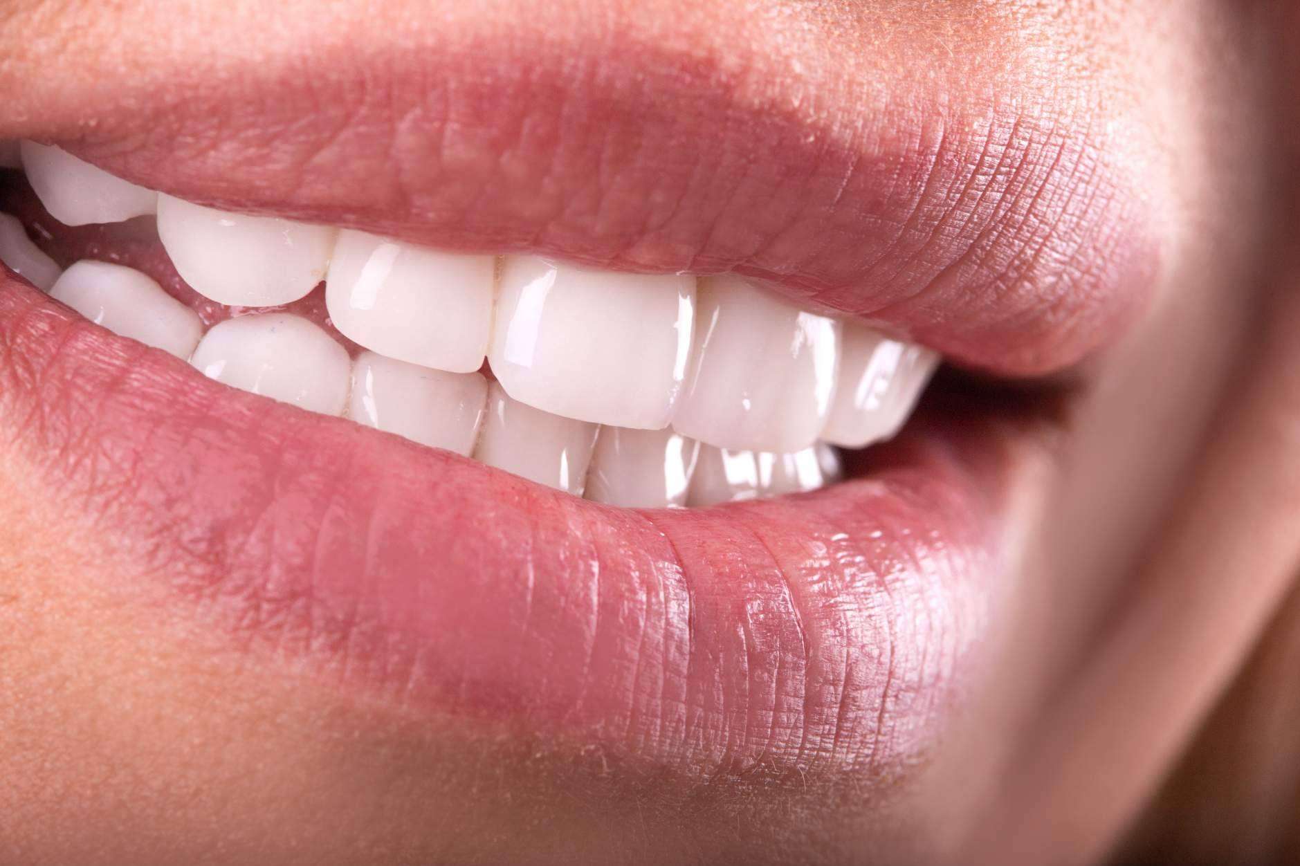 Clínica Sonrisas de Corrales Dental, profesionalidad y calidad en implantes dentales