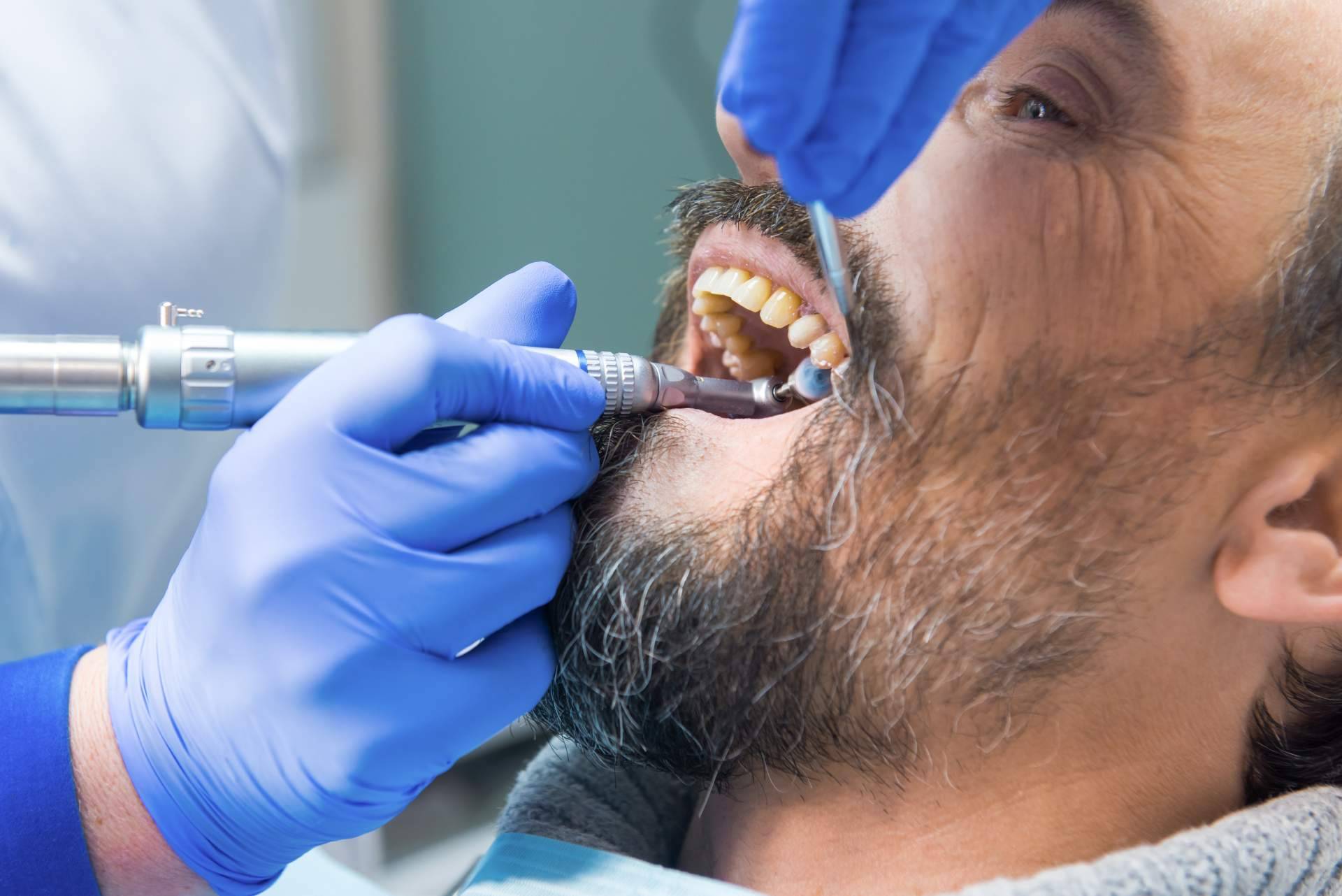 Helident Clínica Dental destaca la importancia de las limpiezas dentales profesionales