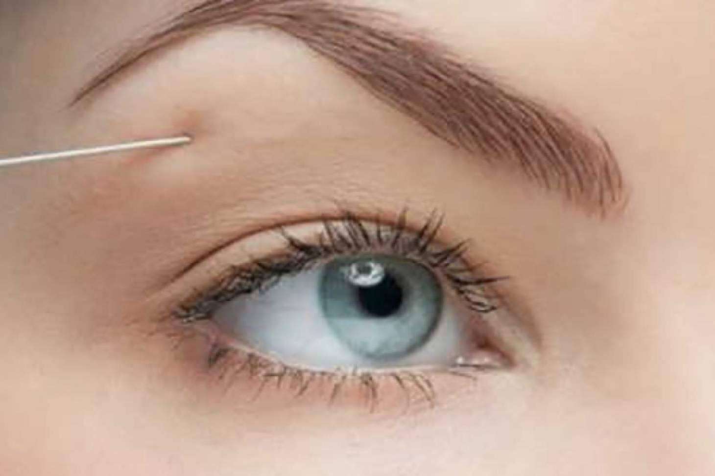 Diseño de cejas con bótox en Castellón de la mano de la Clínica de Medicina Estética Sánchez Peral