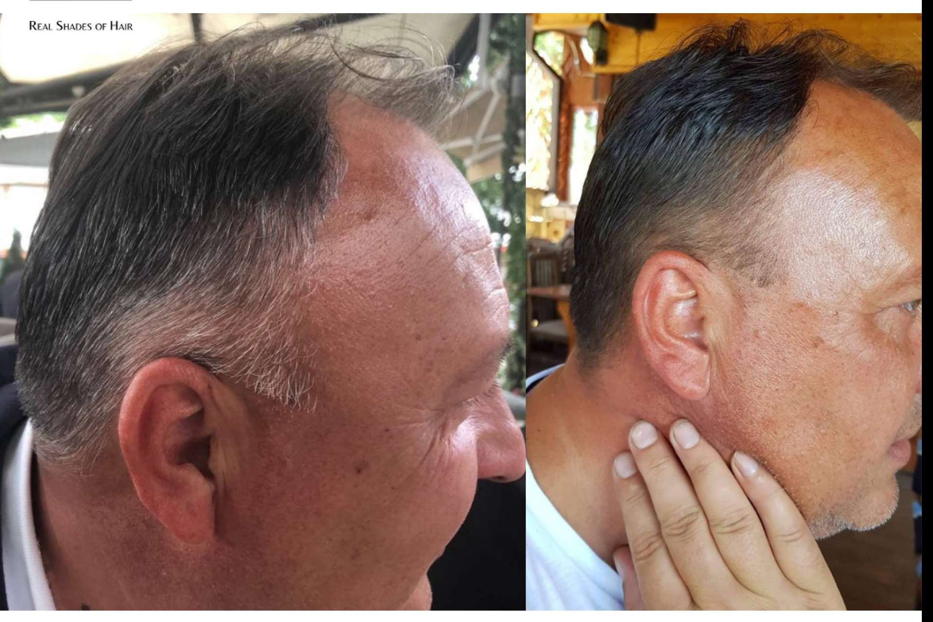 ¿Qué factores influyen en la aparición de canas en los jóvenes?