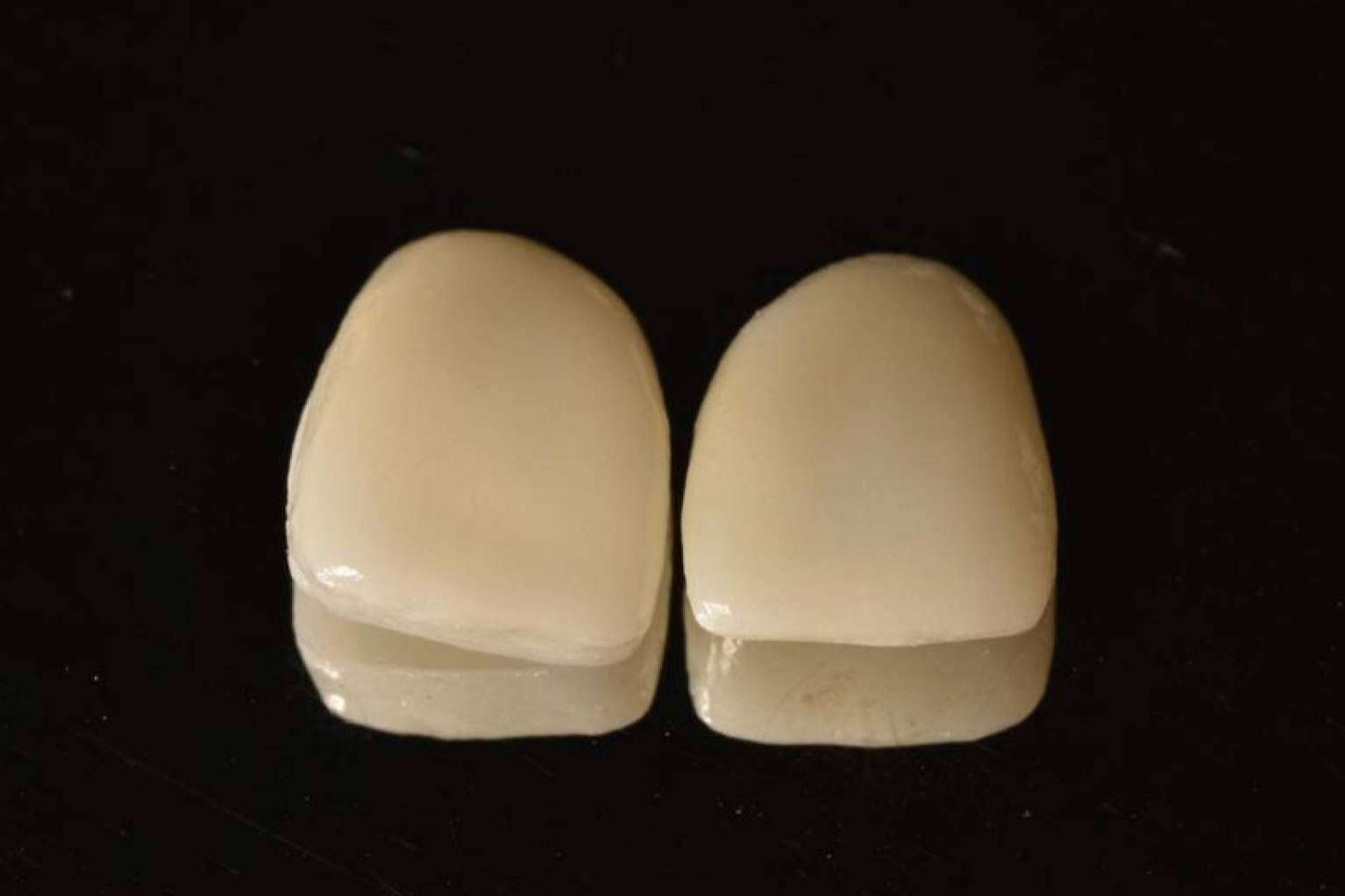 Las amplias ventajas de los tratamientos de estética dental, por Implant Clinics