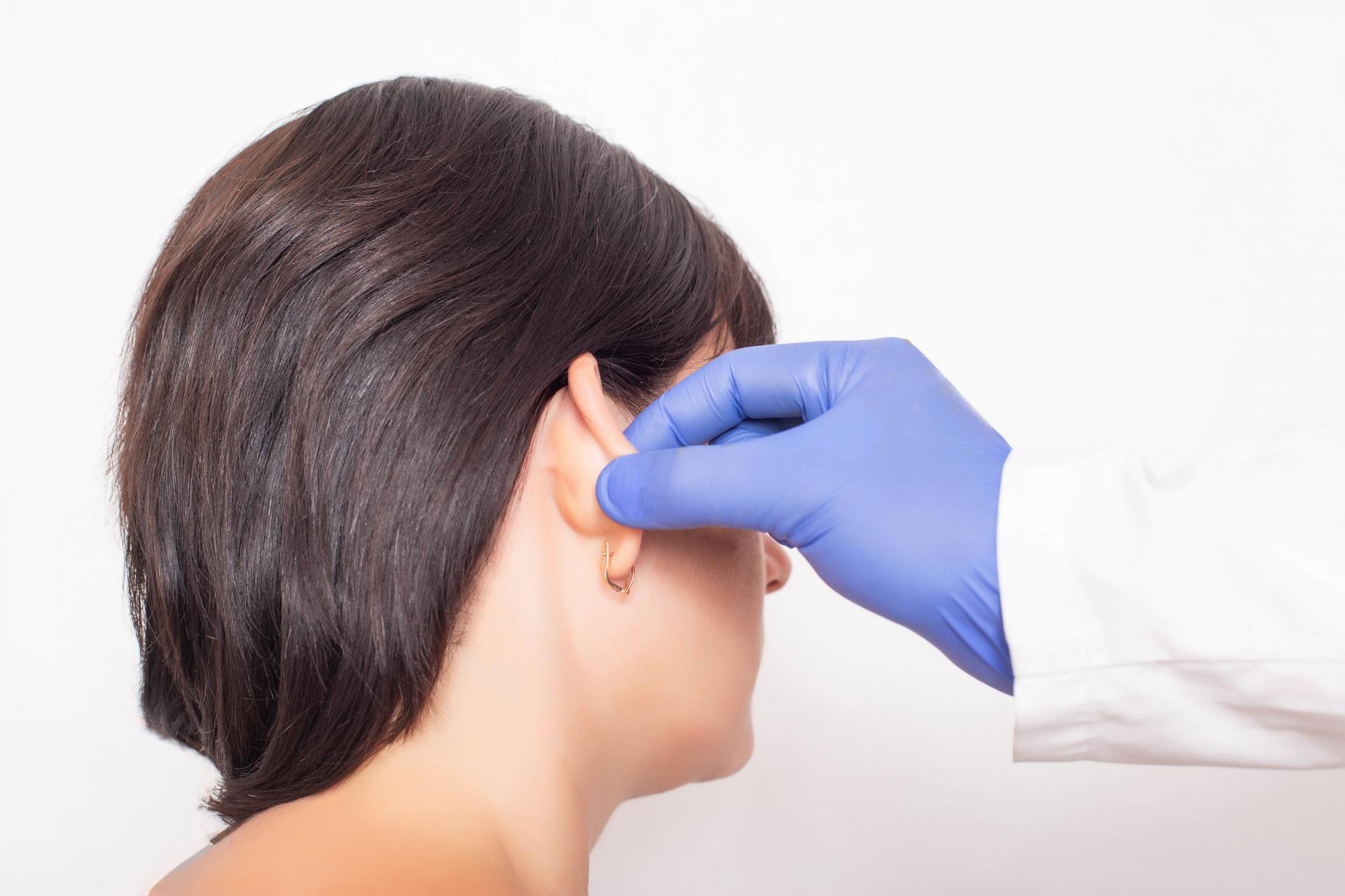 Otoplastia, una intervención quirúrgica mínimamente invasiva realizada por el Doctor Luis Miguel Beltrán