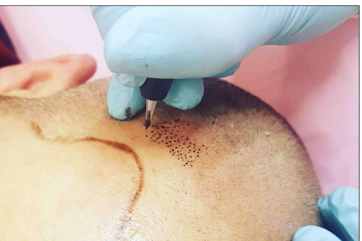 Los profesionales de la micropigmentación pueden ampliar sus conocimientos y aprender técnicas de micropigmentación capilar en el centro VG Virginia Gómez