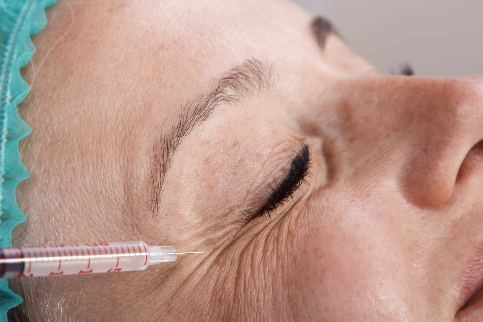 Policlínica ICD realiza el lifting facial sin cirugía y otros tratamientos