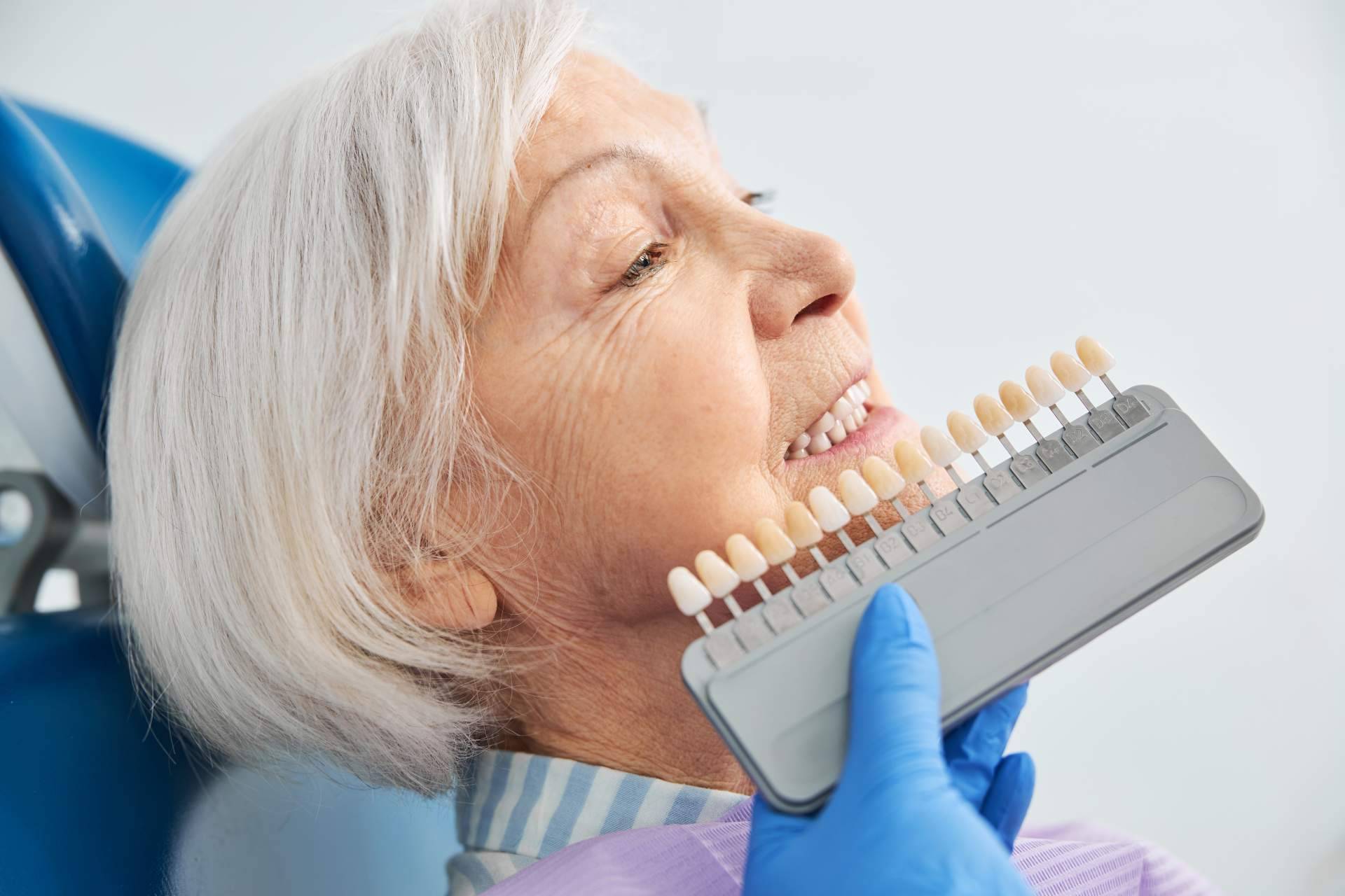 Policlínica ICD y sus limpiezas dentales y blanqueamientos