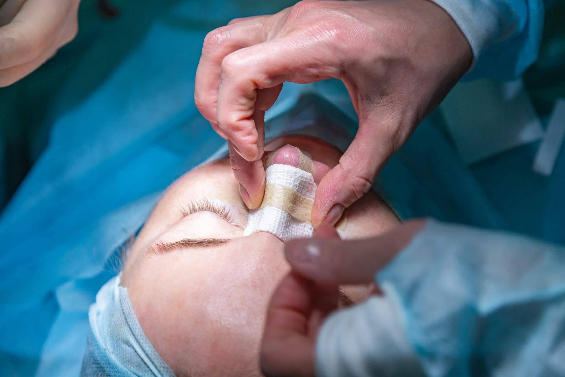 Rinoplastia ultrasónica o cirugía plástica de nariz de la mano de Model Bell