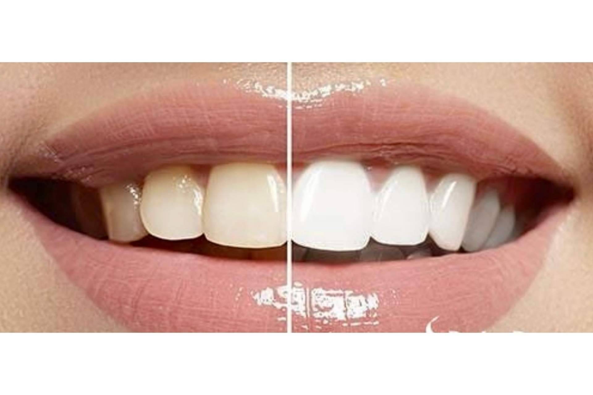 DeltaDent, la clínica dental de Madrid para lucir una sonrisa bonita