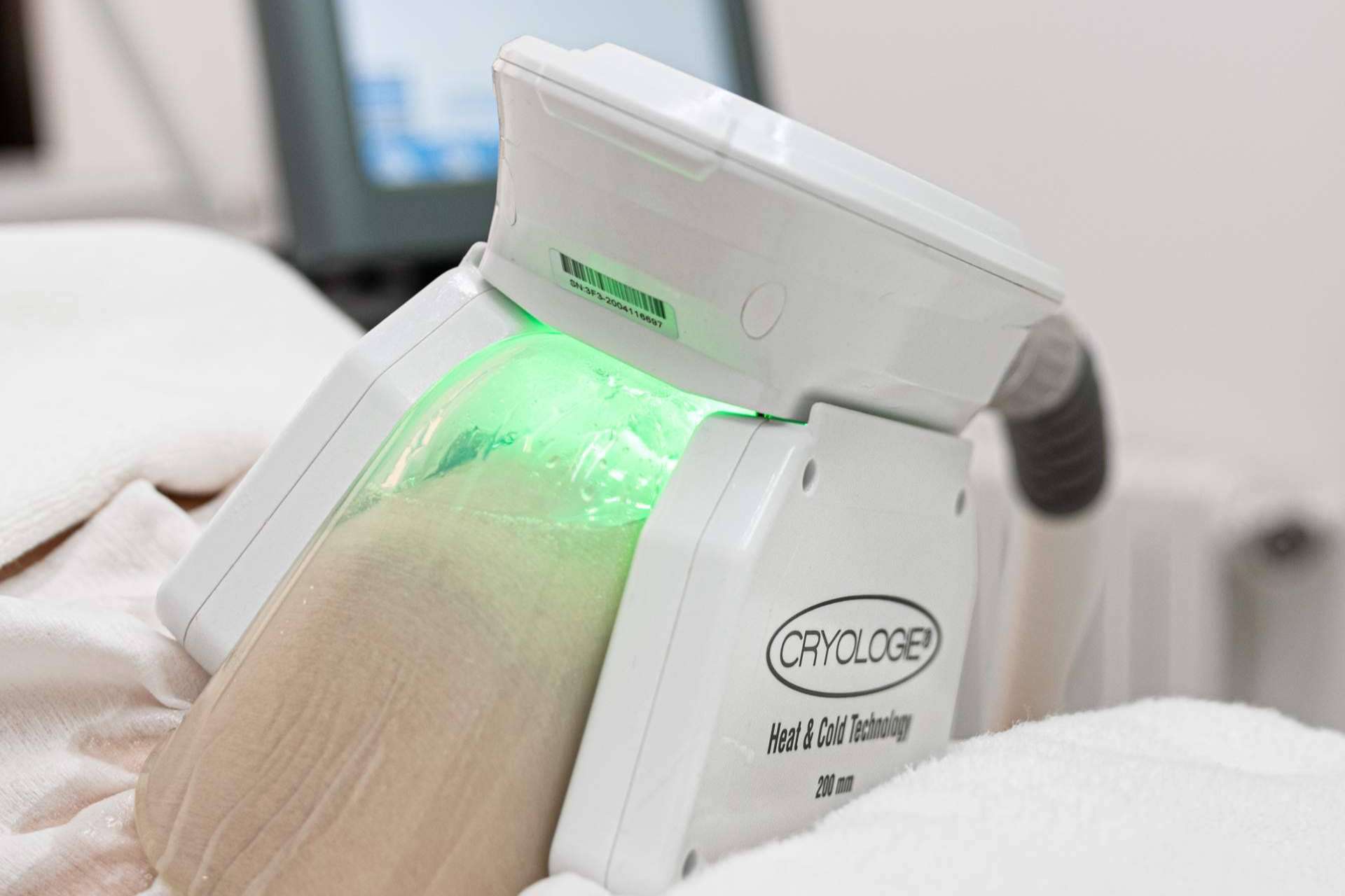 ¿Cómo reducir la grasa localizada? Tratamientos combinados de estimulación electromagnética y criolipólisis