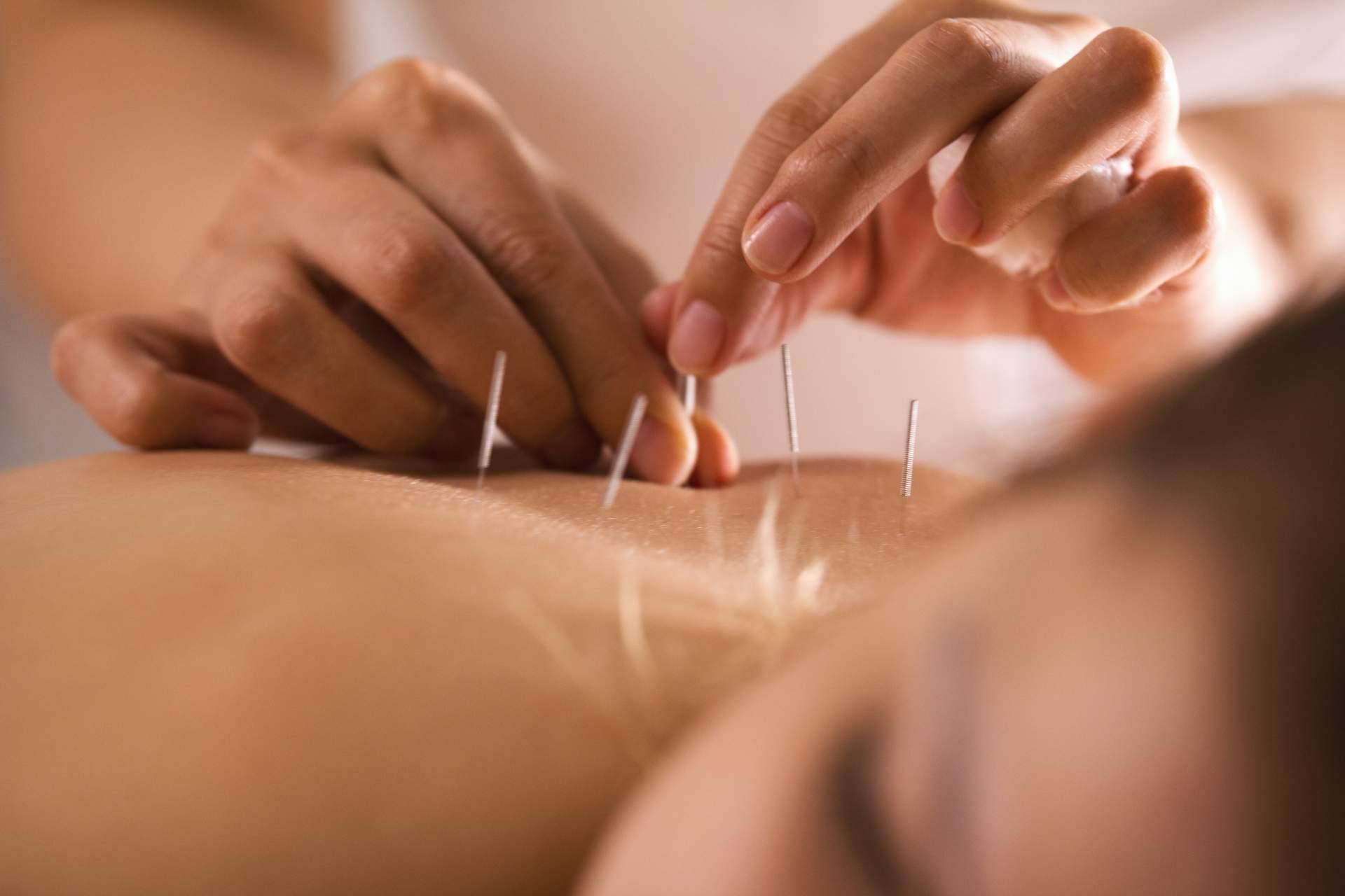 Trabajar de acupuntor y osteópata con formación internacional profesional