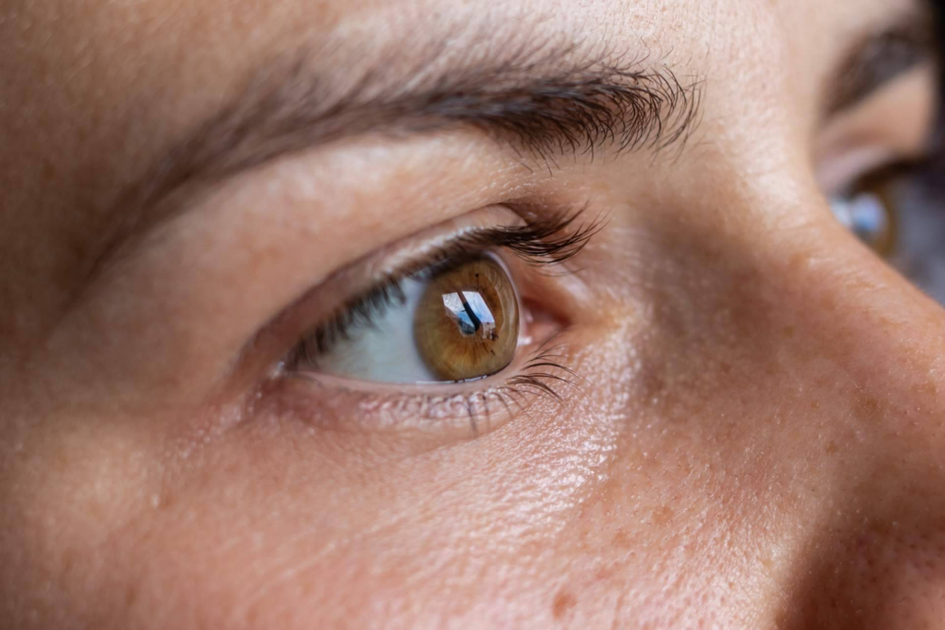 Élite Capilar y sus trasplantes de cejas con el método Zafiro