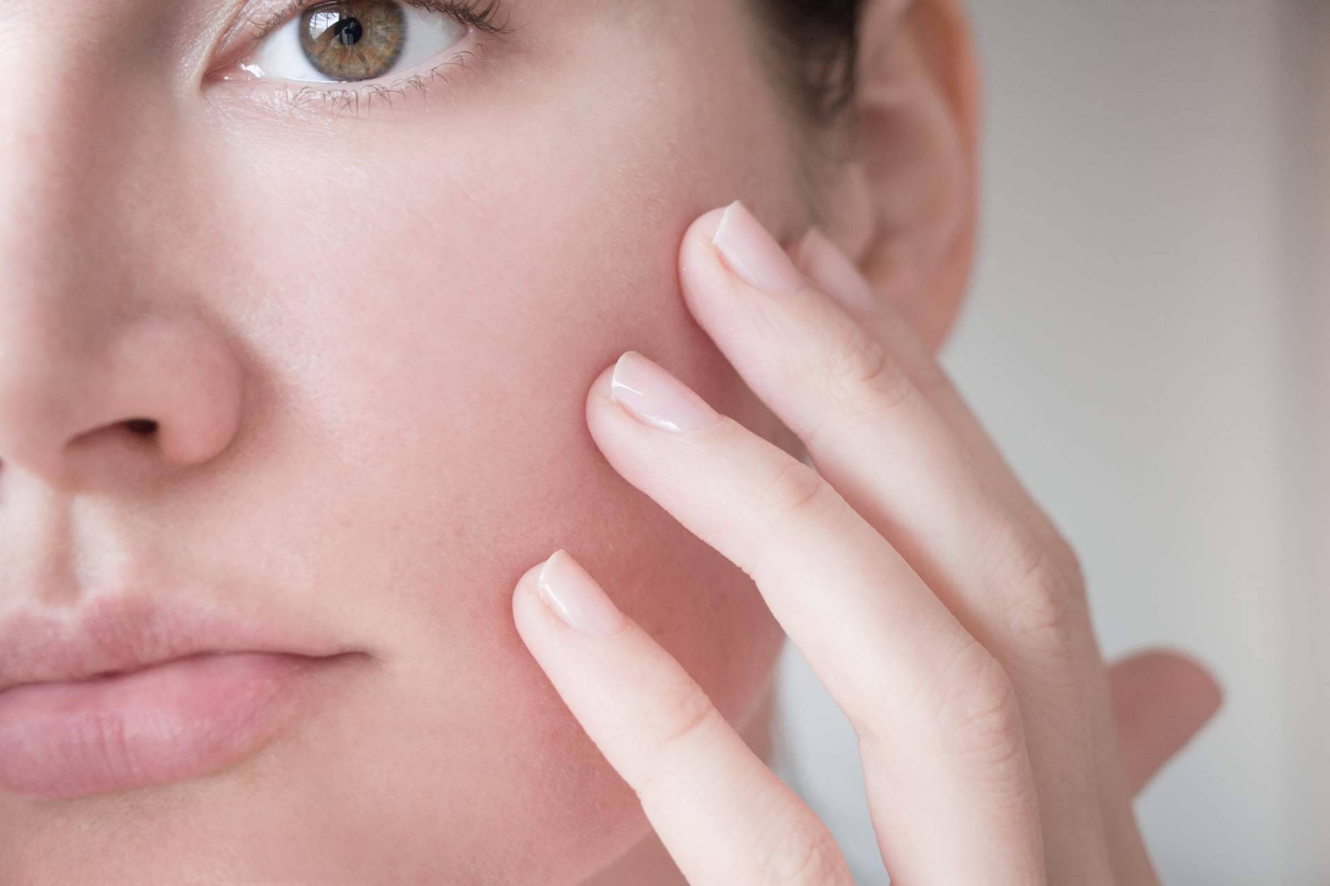 Tratar y prevenir las manchas en la piel en verano, por Farmacia Laura Garín