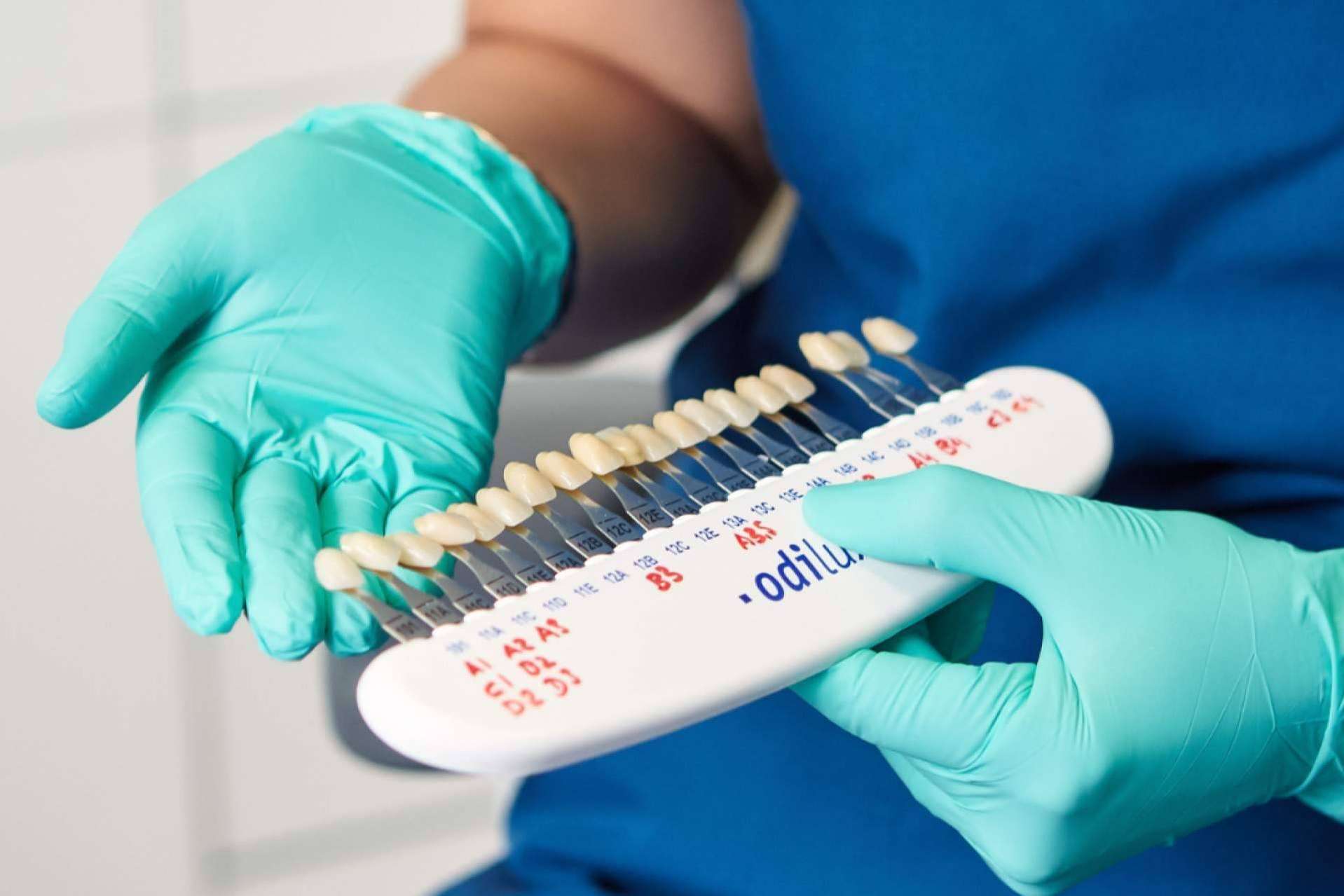 ¿Qué tipos de blanqueamiento dental hay?, de la mano de Bordonclinic