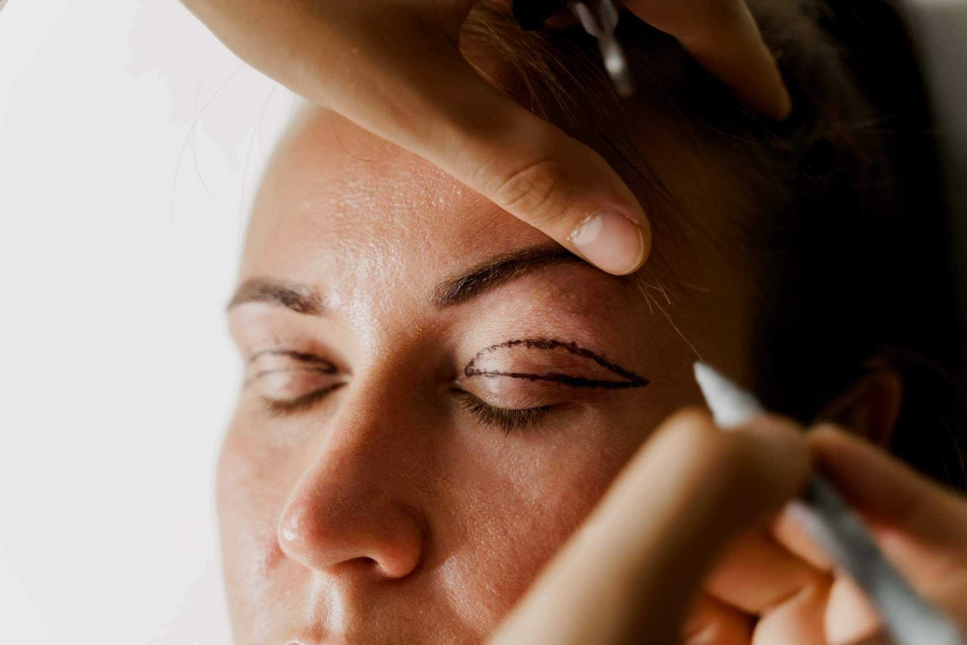Uno de los referentes de blefaroplastia mínimamente invasiva de Barcelona es la Clinica de Medicina Estética Elegansse