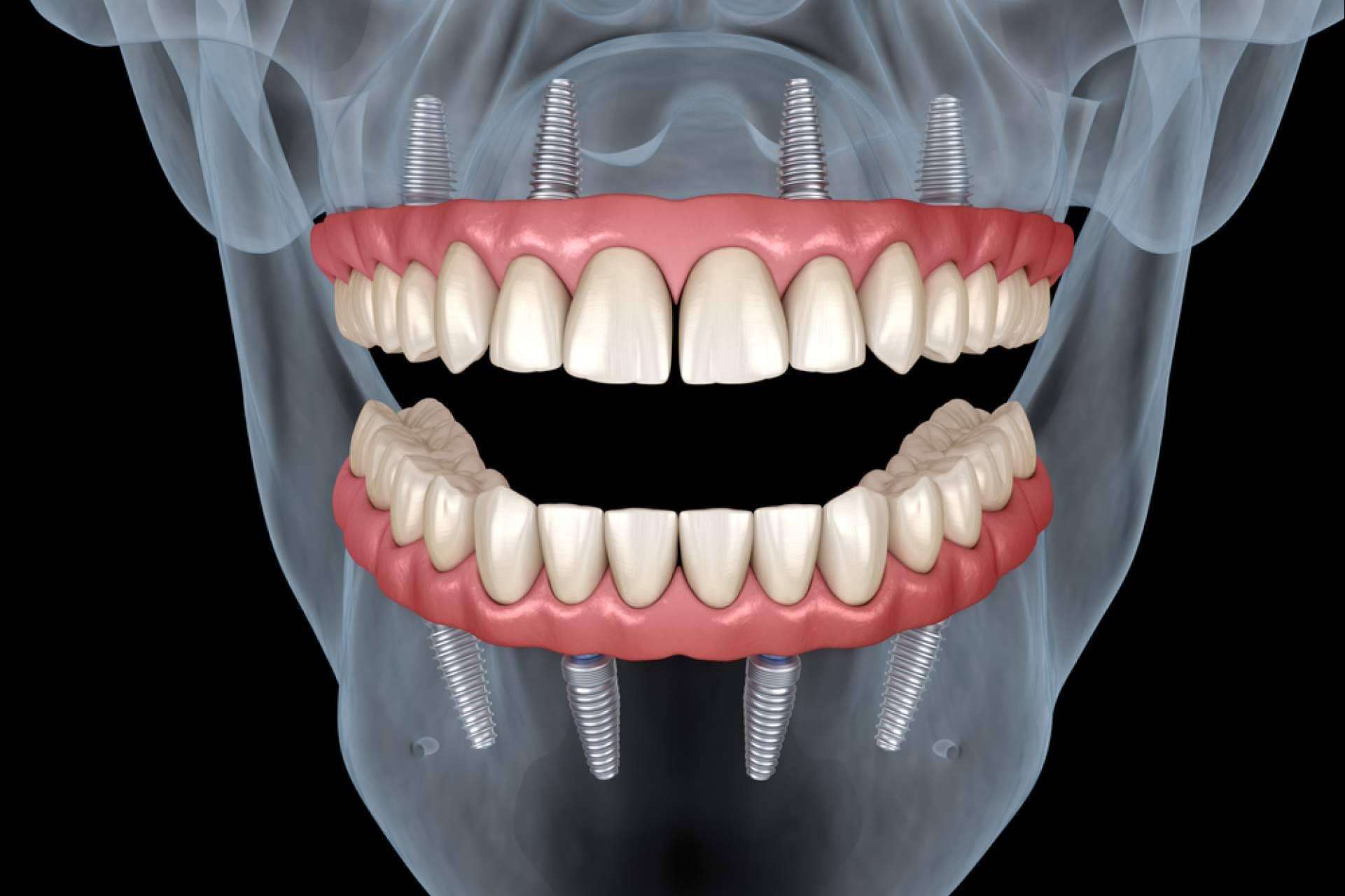 La clínica dental de Chamartín DeltaDent brinda una sonrisa perfecta