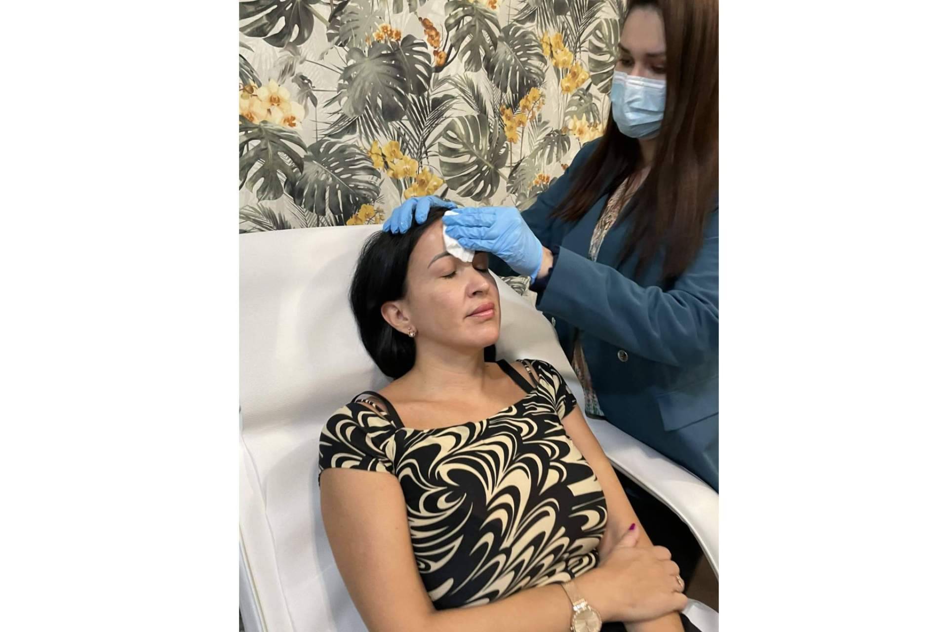Peeling químico, qué es y qué beneficios tiene para la piel, con Cecilia Arthur