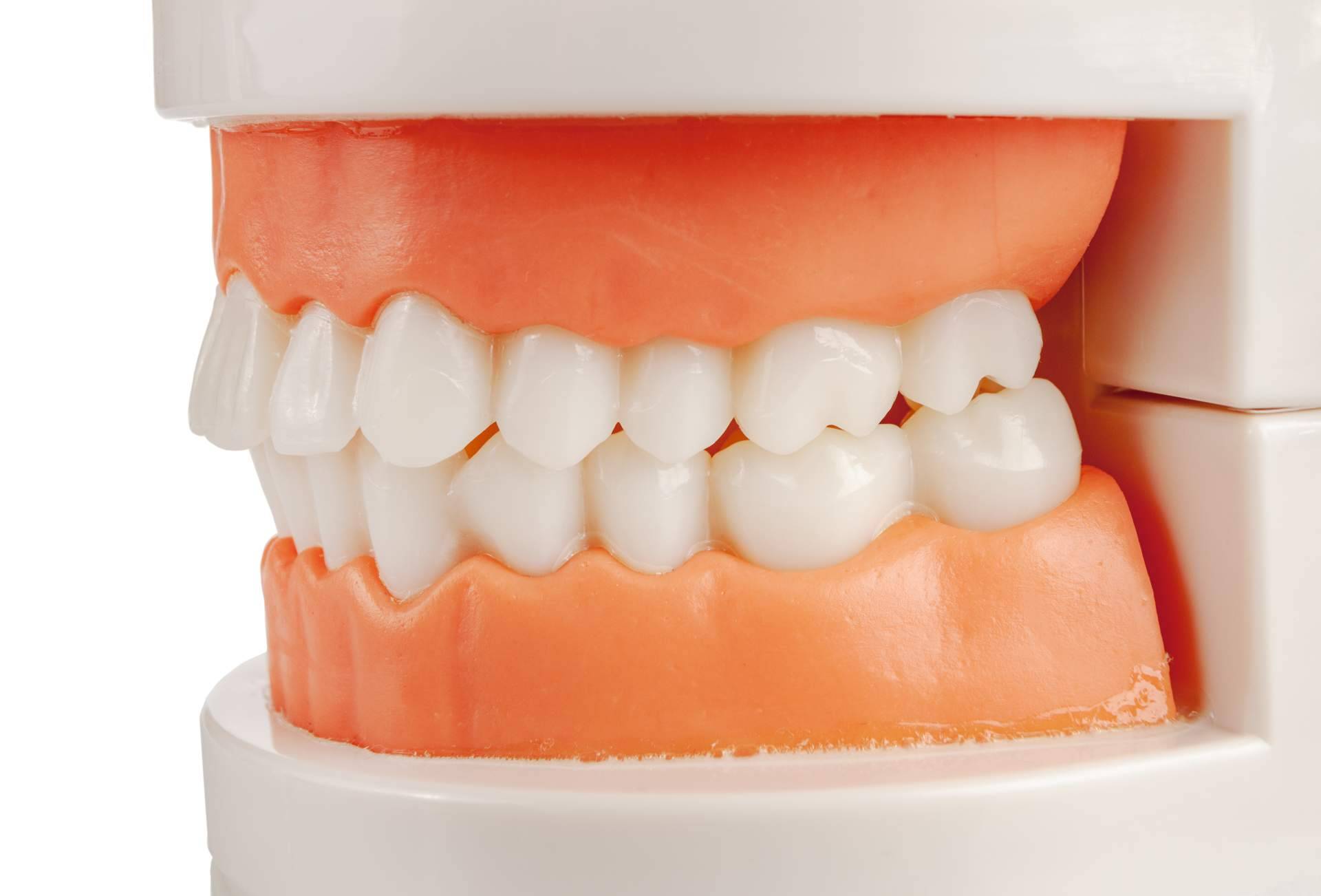 La Clínica Calvo de Mora dispone de expertos en cirugía ortognática que mejoran la estética de la sonrisa de sus pacientes