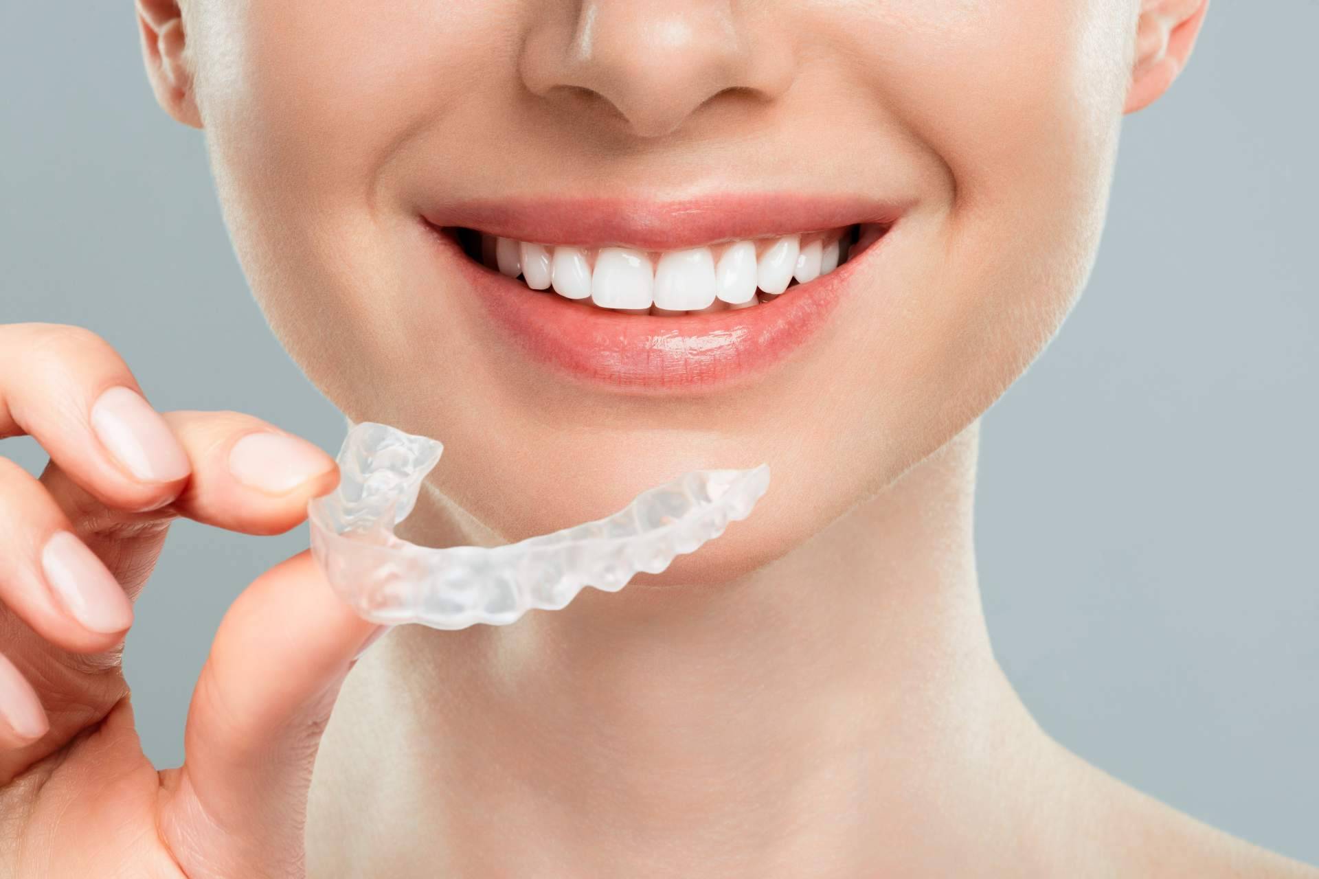 Tener una sonrisa perfecta gracias a los profesionales de la clínica Carlos Saiz Smile