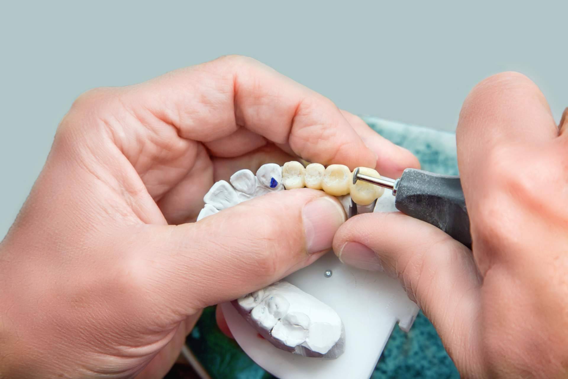 ¿Para qué sirven las prótesis sobre implantes?, con DrMouth