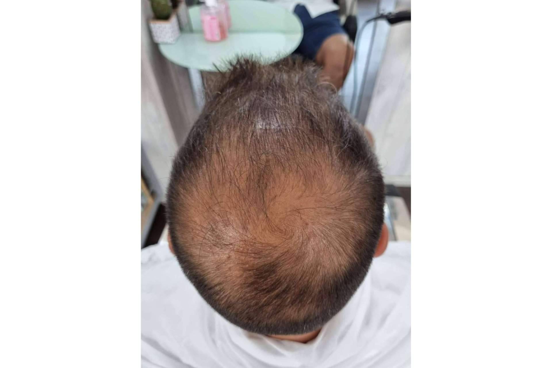 ¿Qué son las fibras capilares?, explicado por Lion Hair