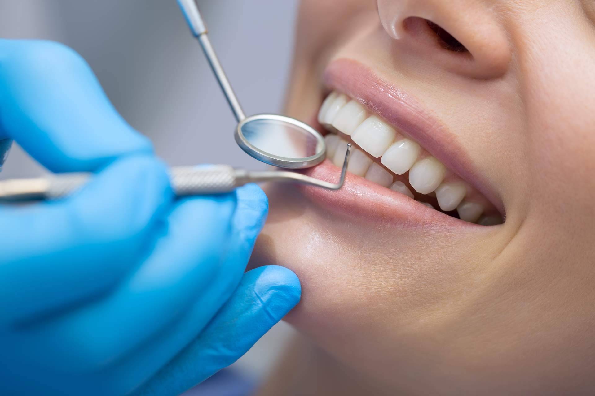 Los profesionales de ResidentLive llevan a cabo todo tipo de tratamientos para la estética dental