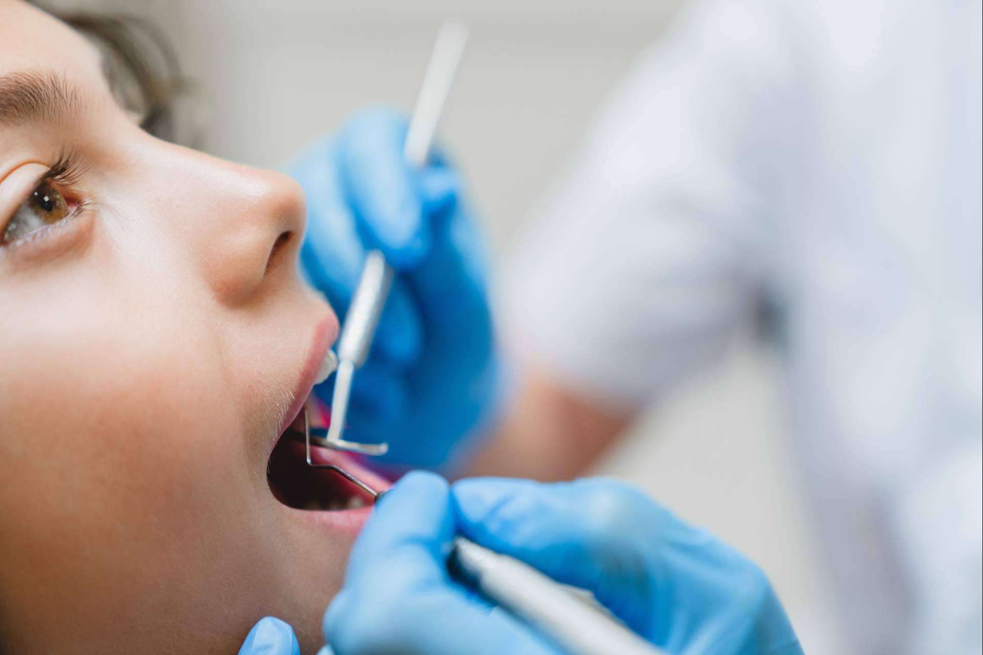Es importante la dieta en la salud bucodental para la prevención de las caries