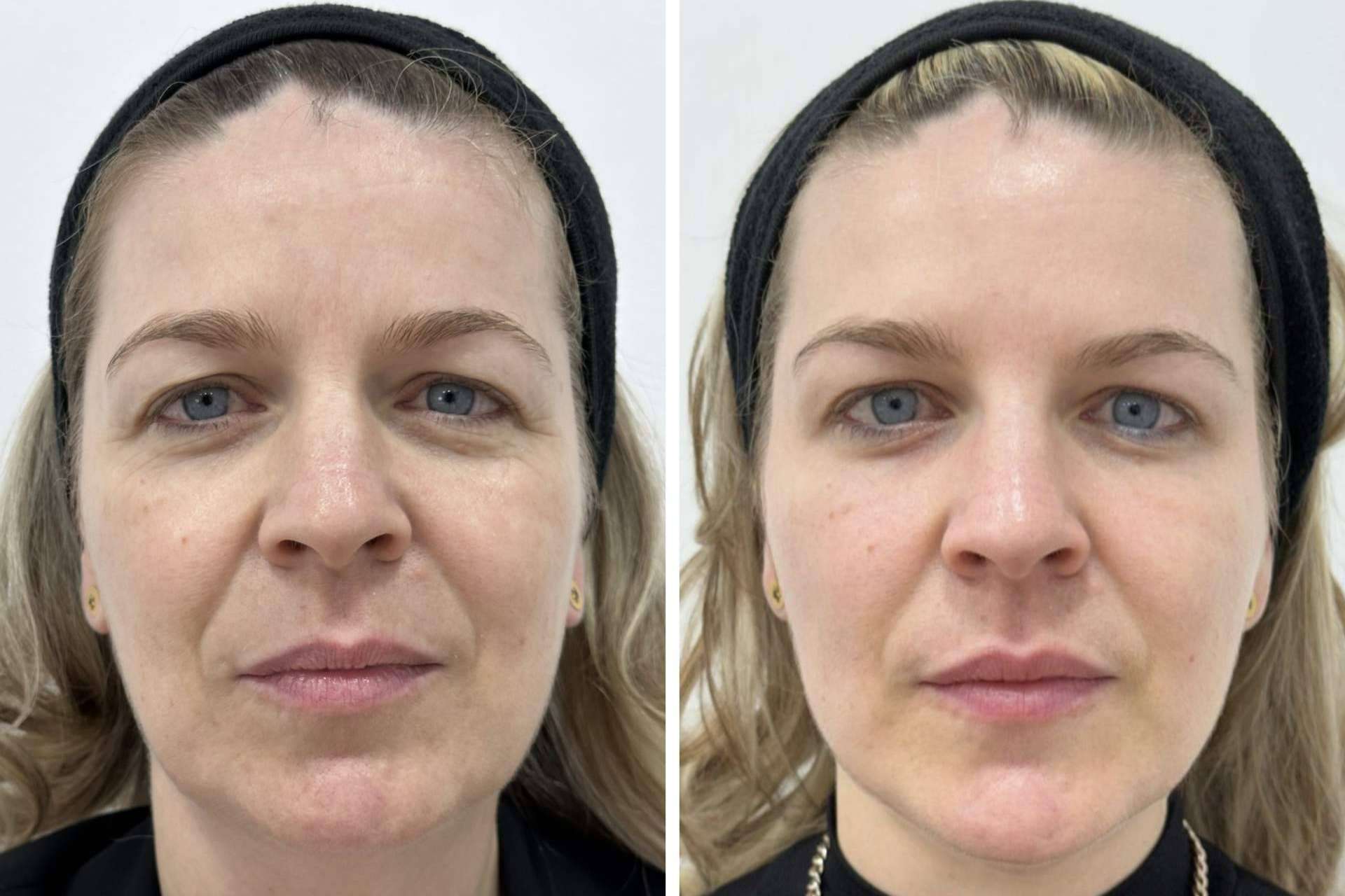 Clínica VISO permite mejorar la apariencia a través de sus tratamientos faciales