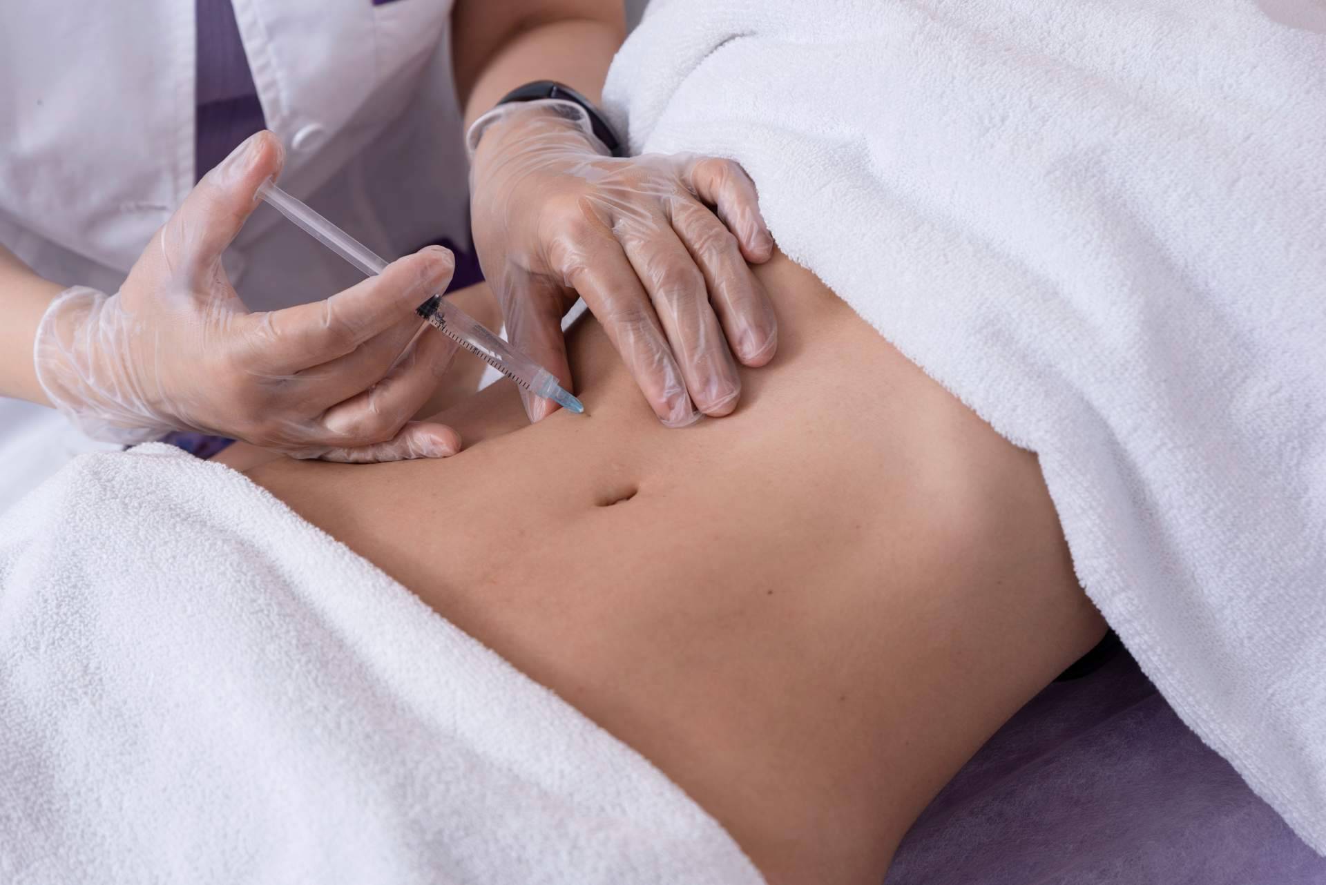 Mesoterapia efectiva contra la celulitis de la mano de Alluring Clinic
