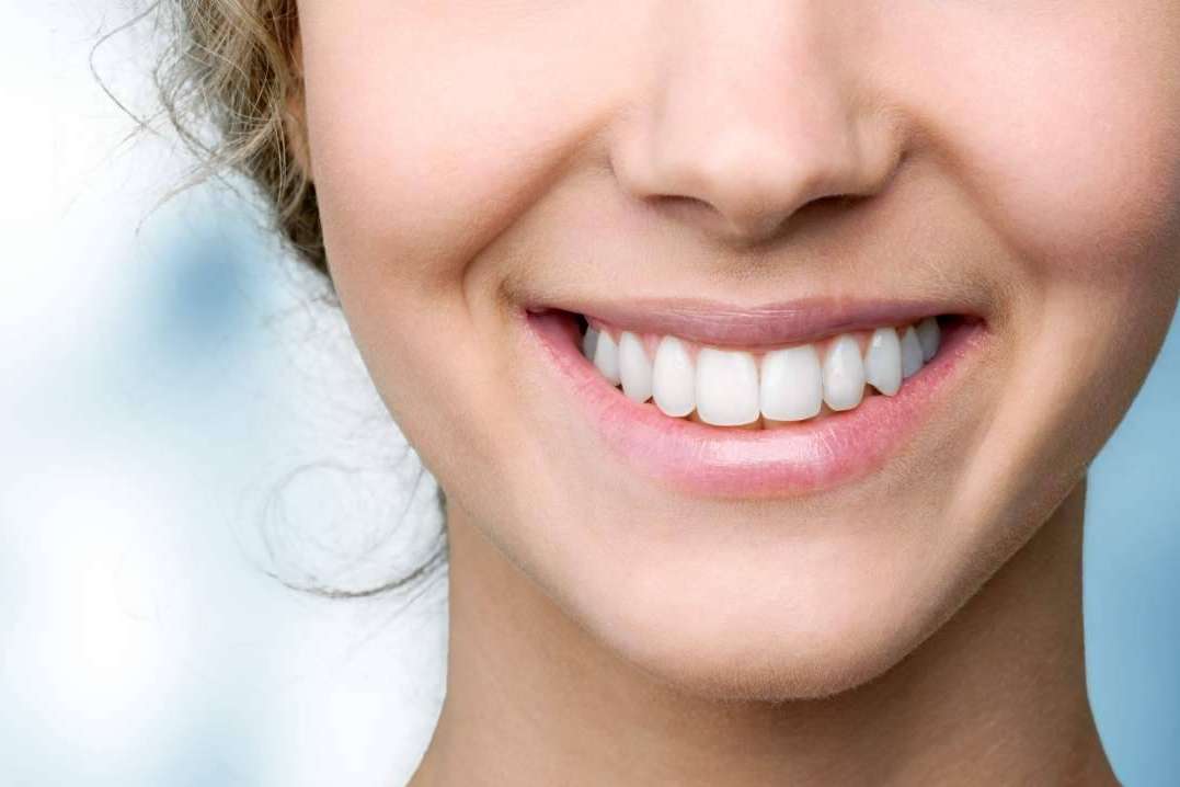 ¿En qué consiste la cirugía de sonrisa gingival?