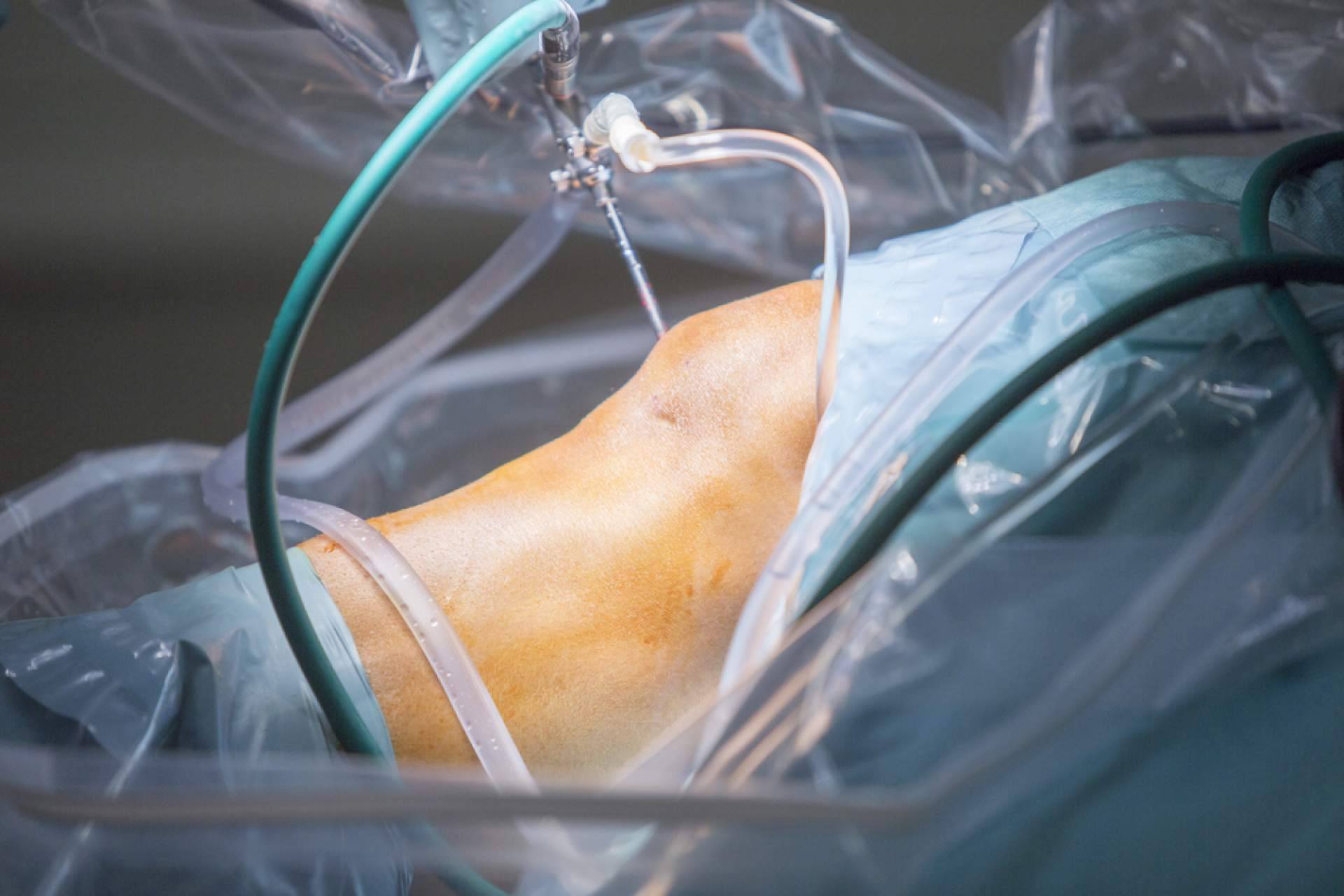 ¿Dónde encontrar tratamientos de artroscopia de rodilla? Clínica Jaime I de Catarroja