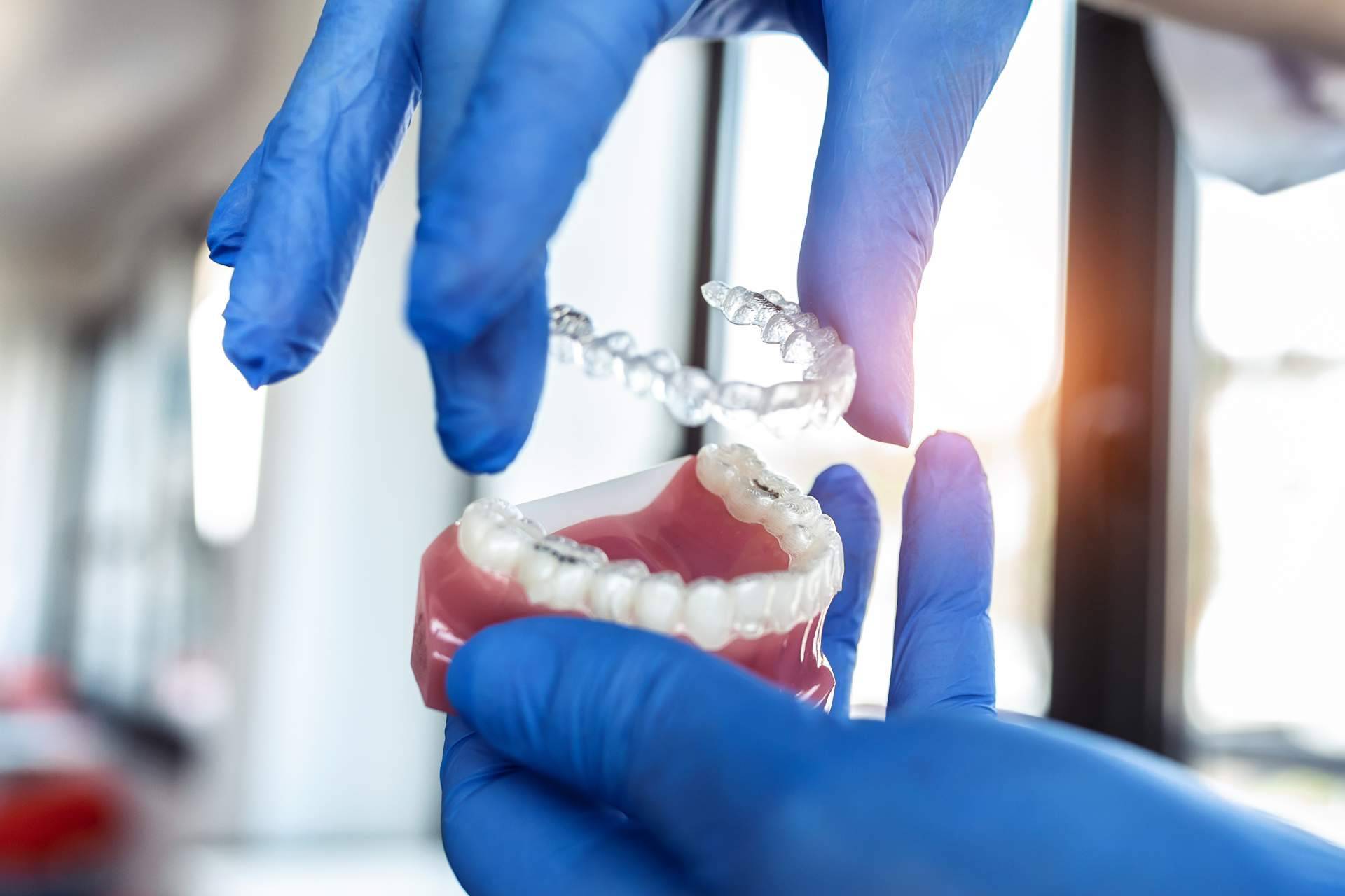 Clínica InterOralia ofrece un tratamiento Invisalign a precios competitivos y resultados excepcionales
