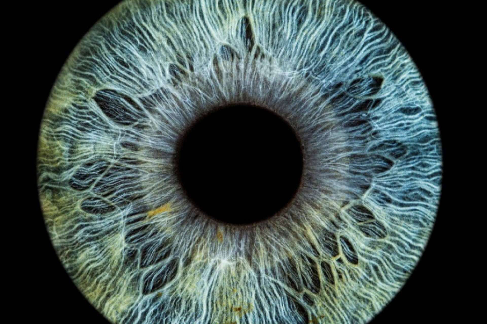 Perfil psicológico sano de los pacientes que llevan a cabo el láser de cambio de color de ojos