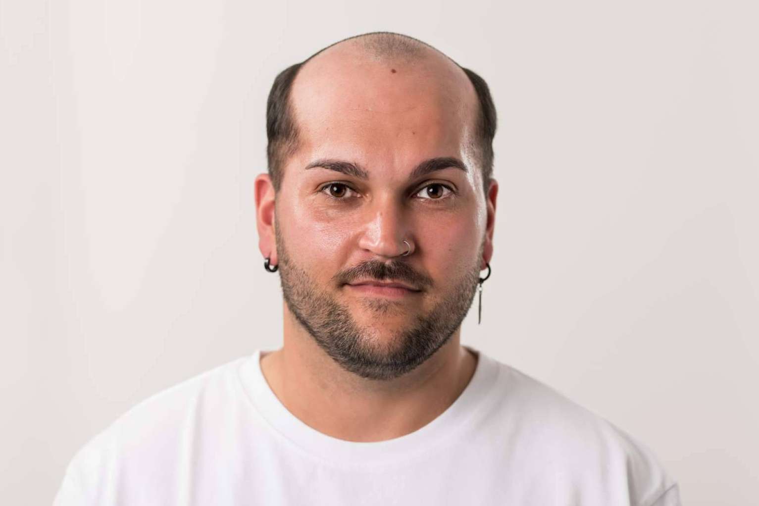 Un mercado en auge, las prótesis capilares para hombre con Hair Inspira