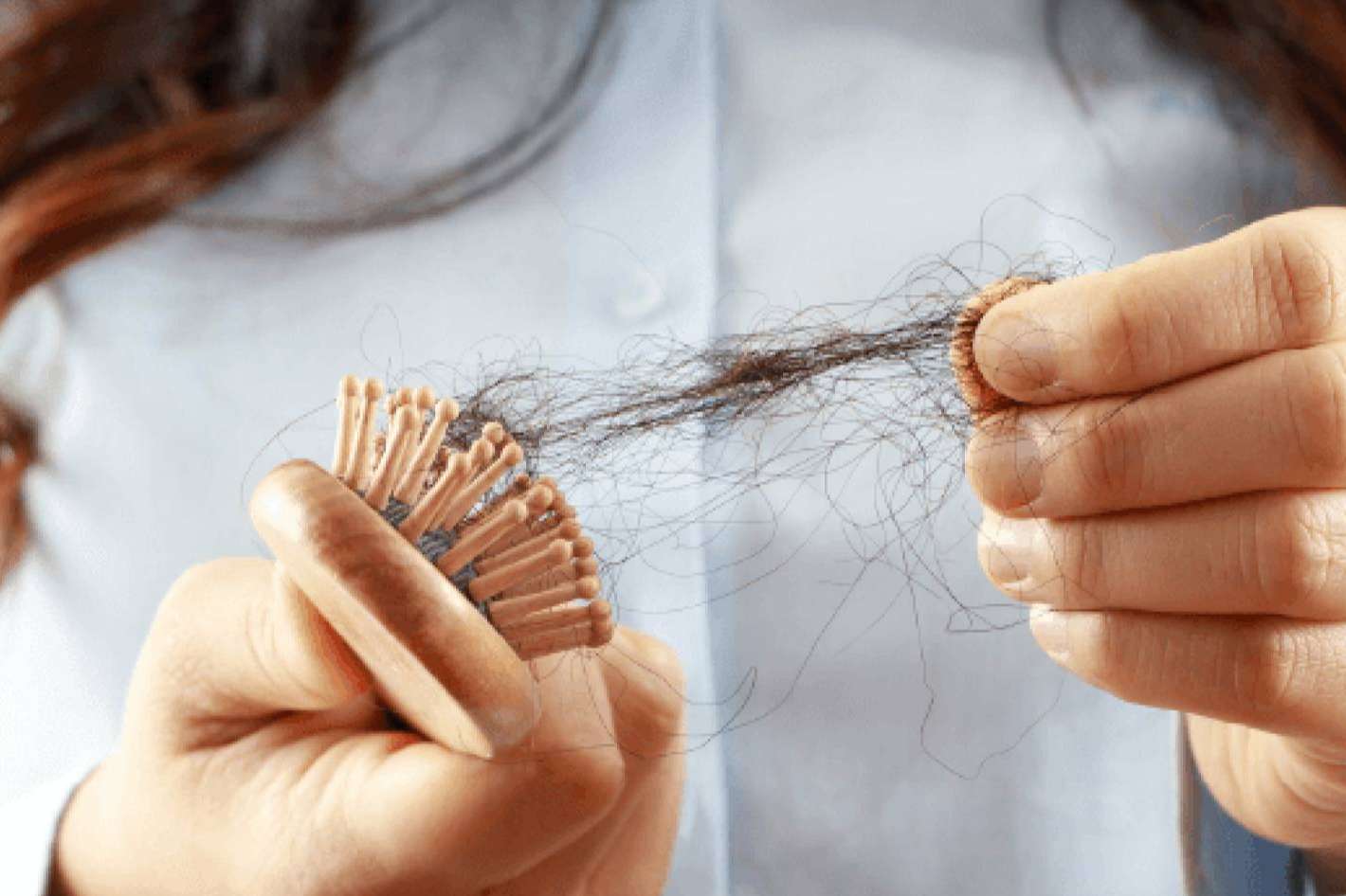 ¿Se puede caer el pelo por estrés?