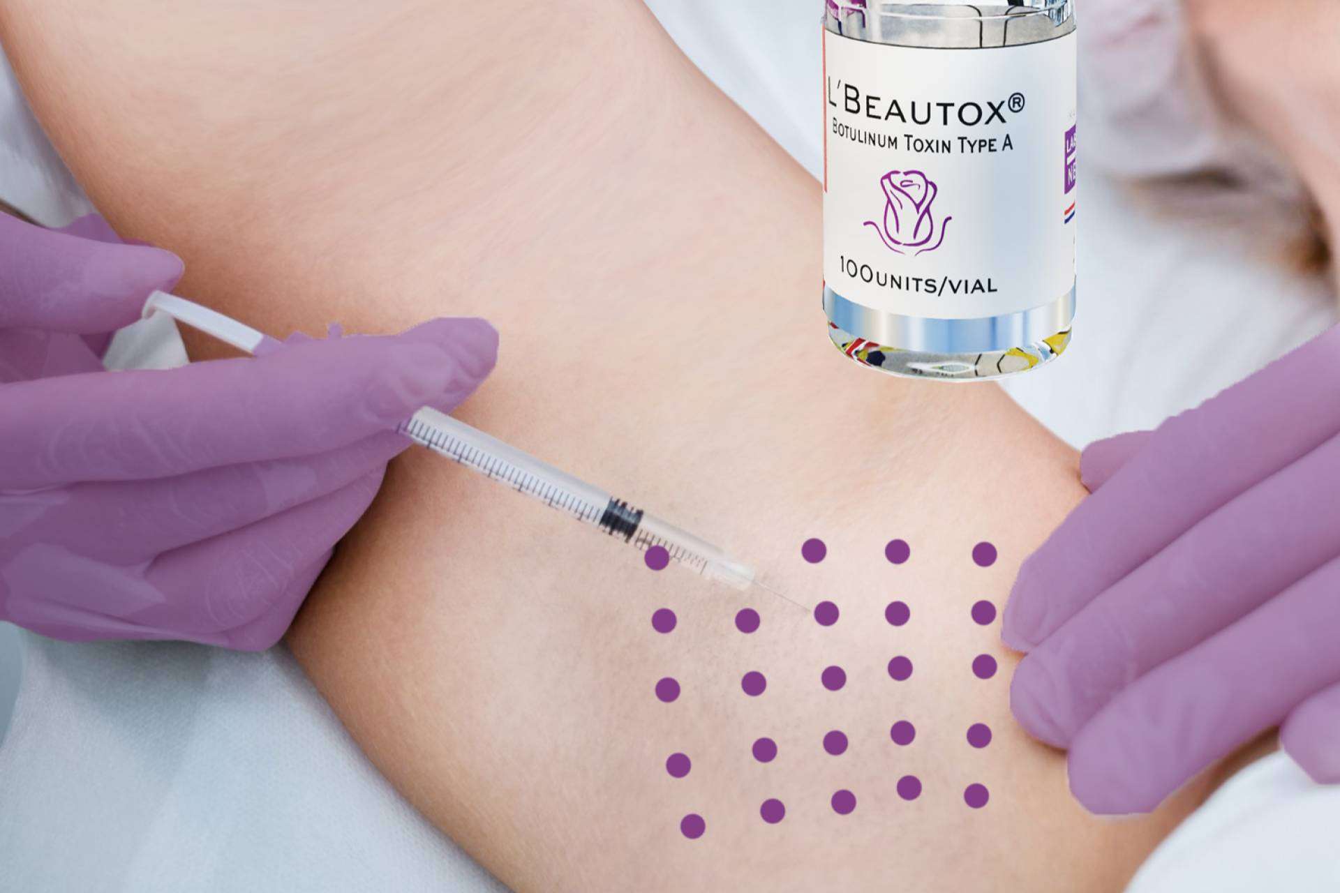 Toxina Botulínica LBEAUTOX, una solución efectiva en el tratamiento de la hiperhidrosis