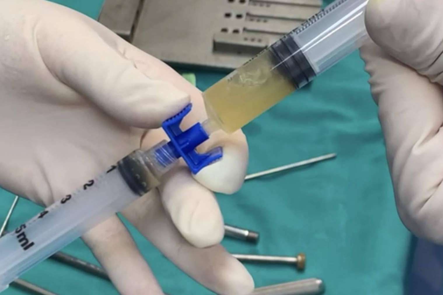 ¿En qué consiste la traumatología regenerativa?