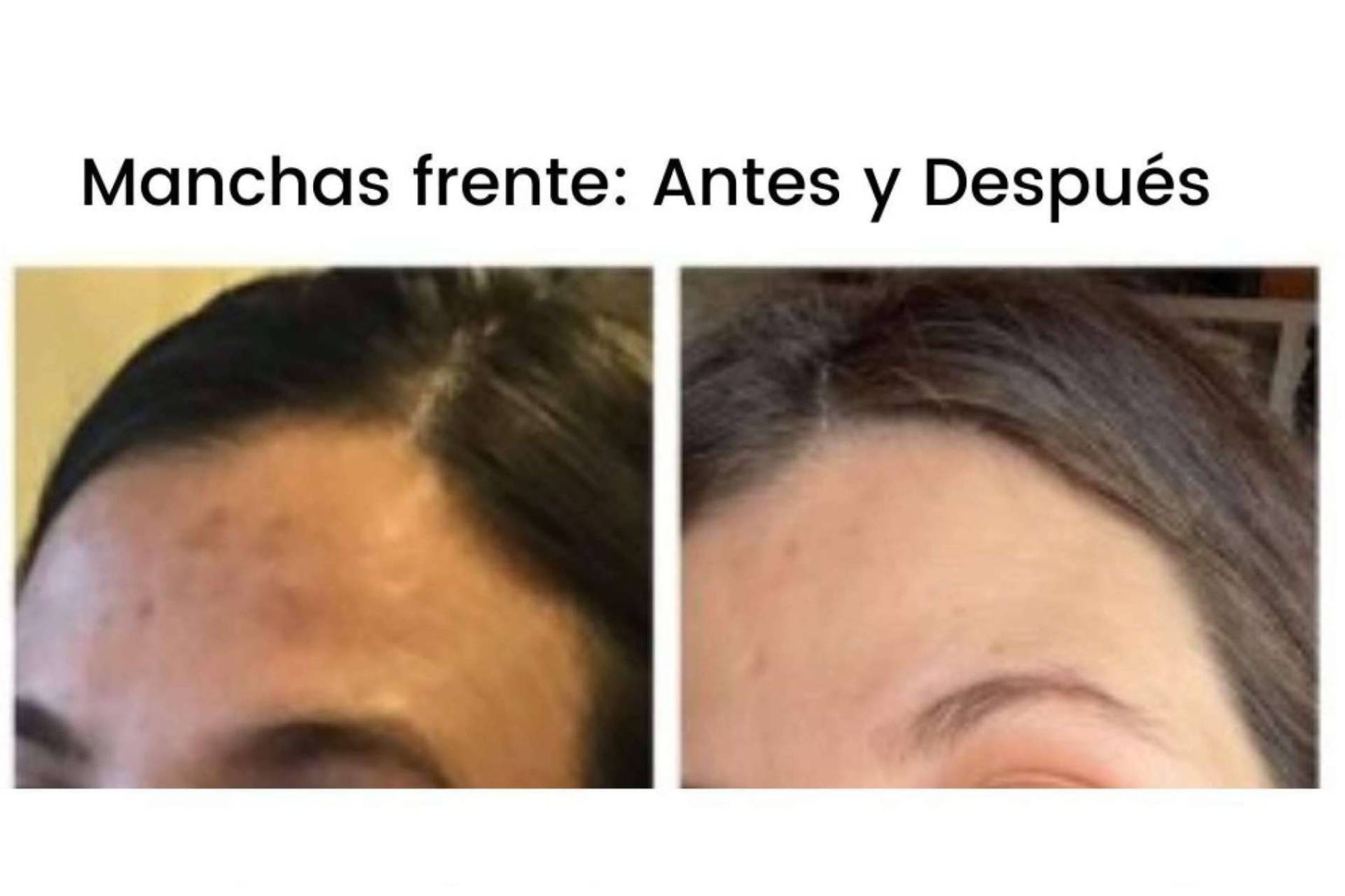 MiCleo&Co ofrece un tratamiento skincare con despigmentante facial para después del verano