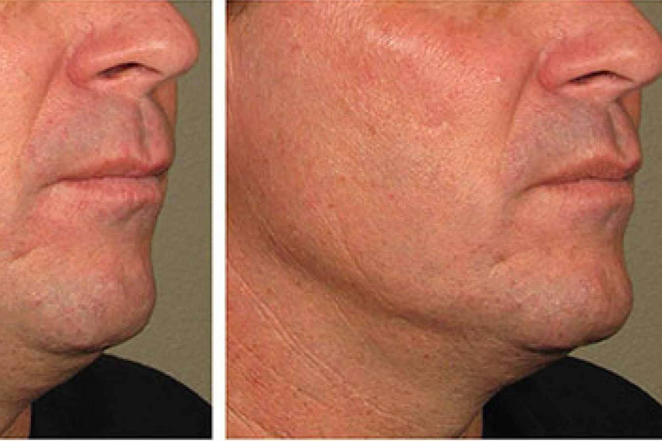 La Clínica Calvo de Mora es una clínica maxilofacial experta en cirugías ortognáticas