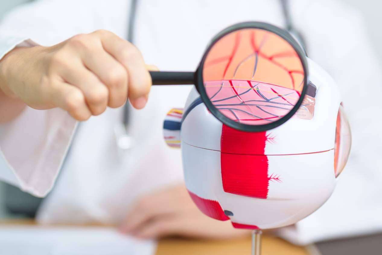 El Departamento de Oftalmología del Instituto Universitario Dexeus habla sobre la retinopatía diabética