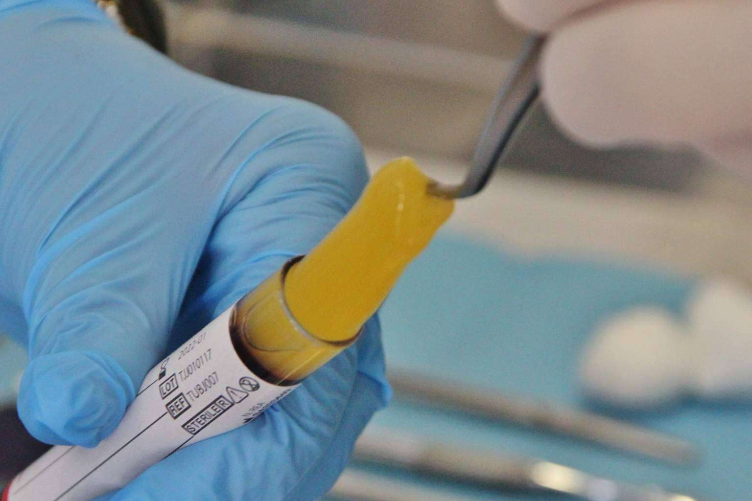 Clínica Biorigenera, especialistas en recuperar la sonrisa y la salud bucodental con implantes dentales cerámicos
