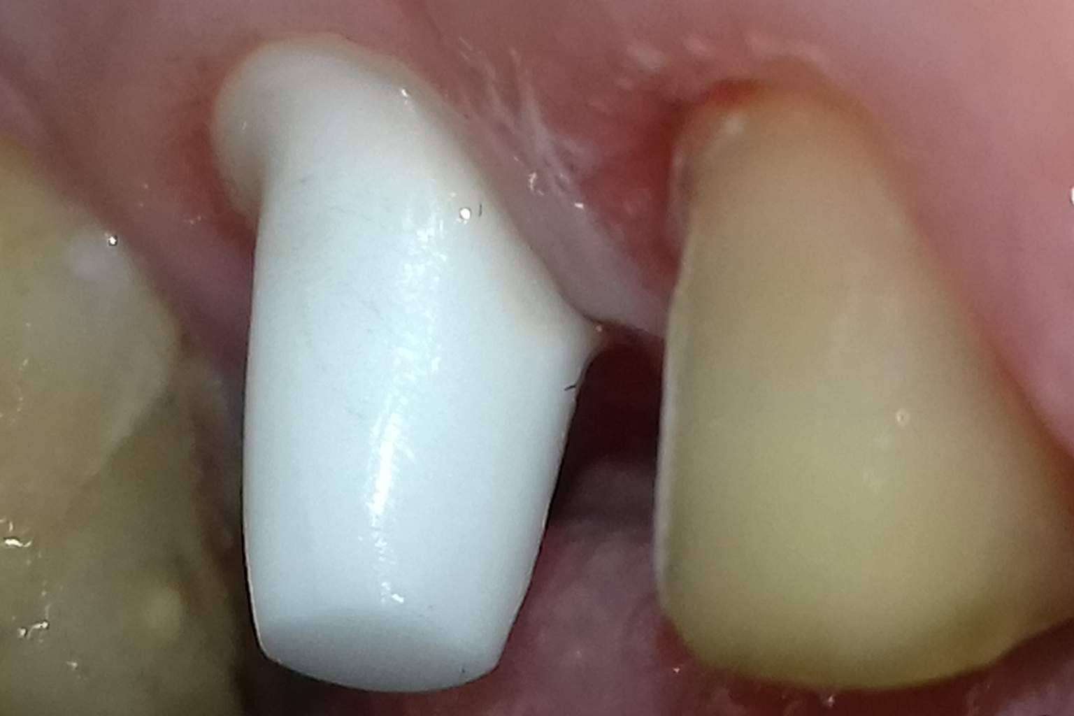 Clínica Biorigenera habla del poder de la sanación interna