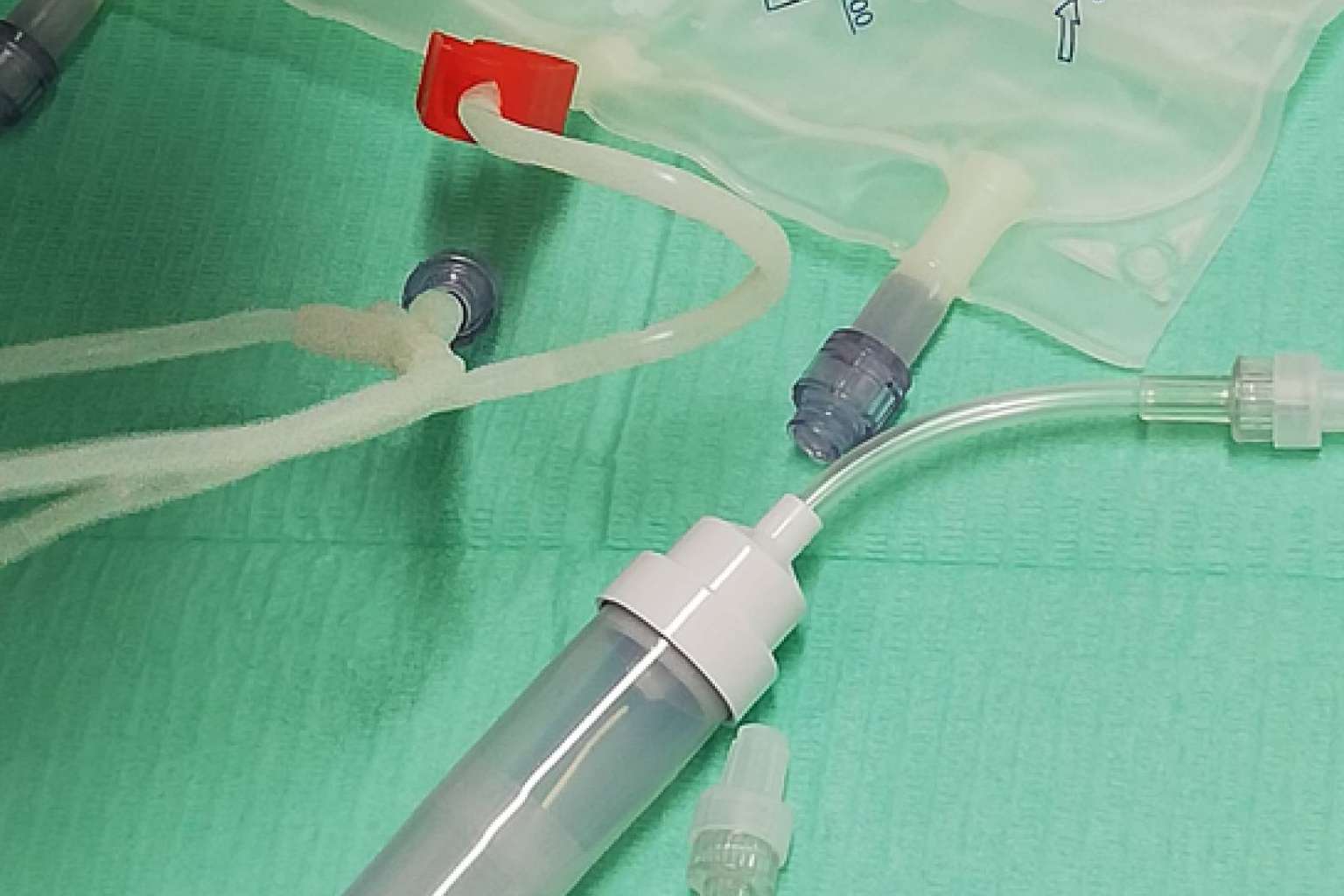 Ozonoterapia en Clínica Biorigenera, innovación en medicina regenerativa