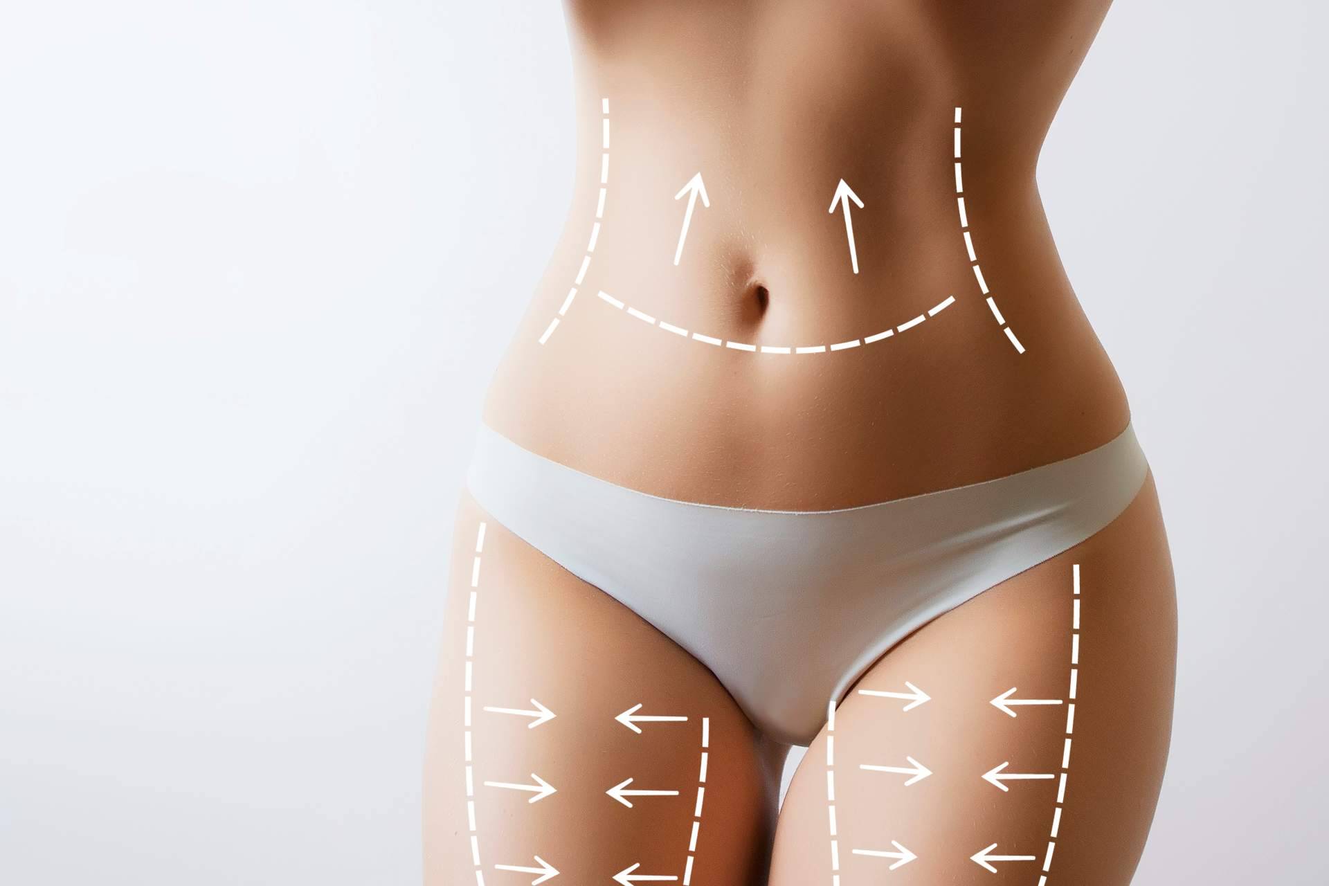Lipo HD, La clave para un cuerpo atlético y definido