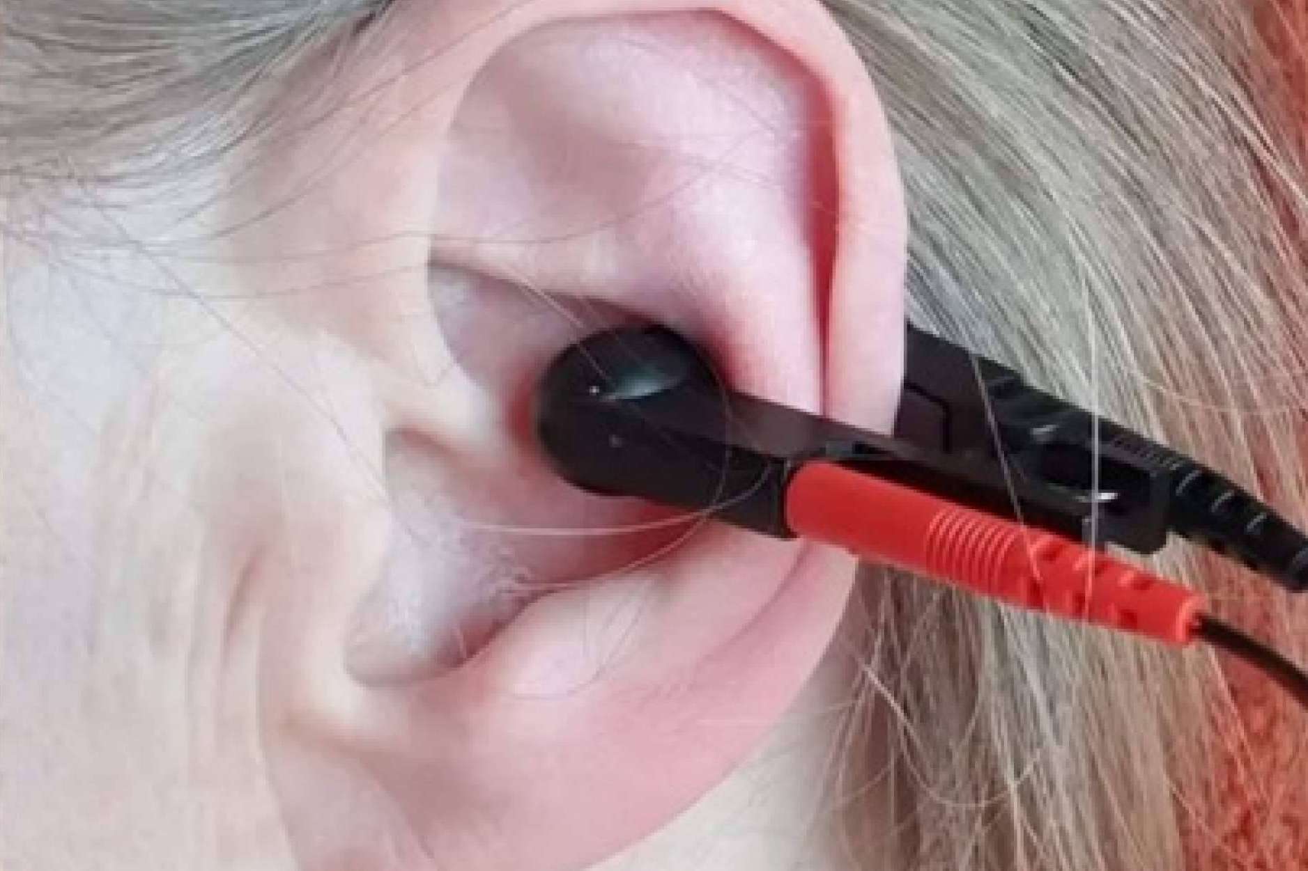 GOGOA presenta ALPERK, revolucionando la neurorrehabilitación