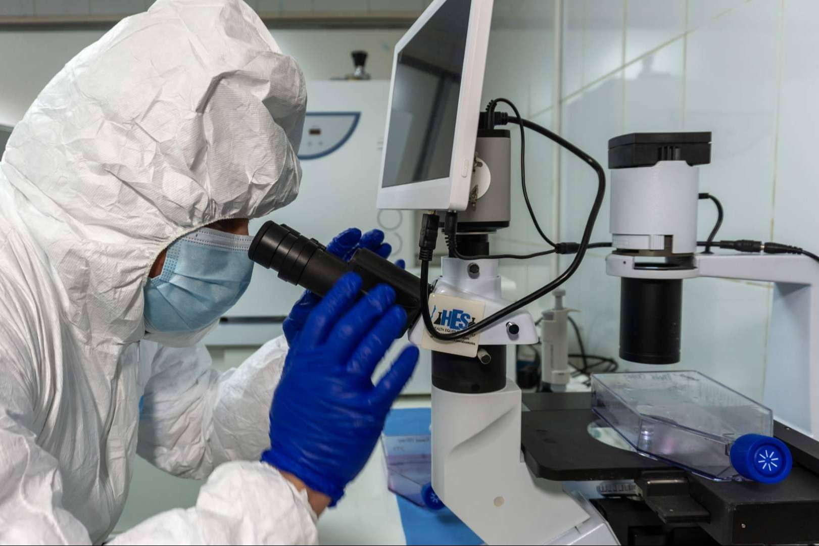 La nueva biotecnología para pacientes con cáncer en etapa 3 y 4; Inmunoterapia personalizada DEXs de Oncovix
