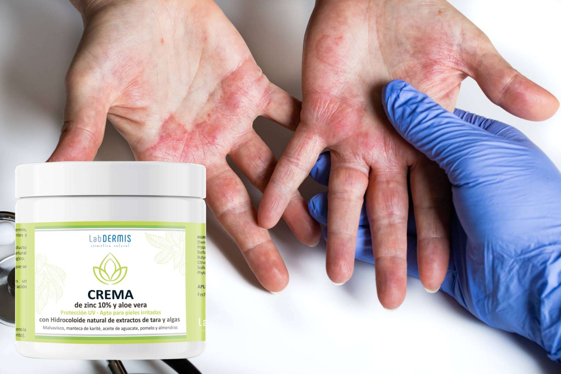 El laboratorio LabDERMIS propone formulas únicas para tratar pieles sensibles y con dermatitis atópica