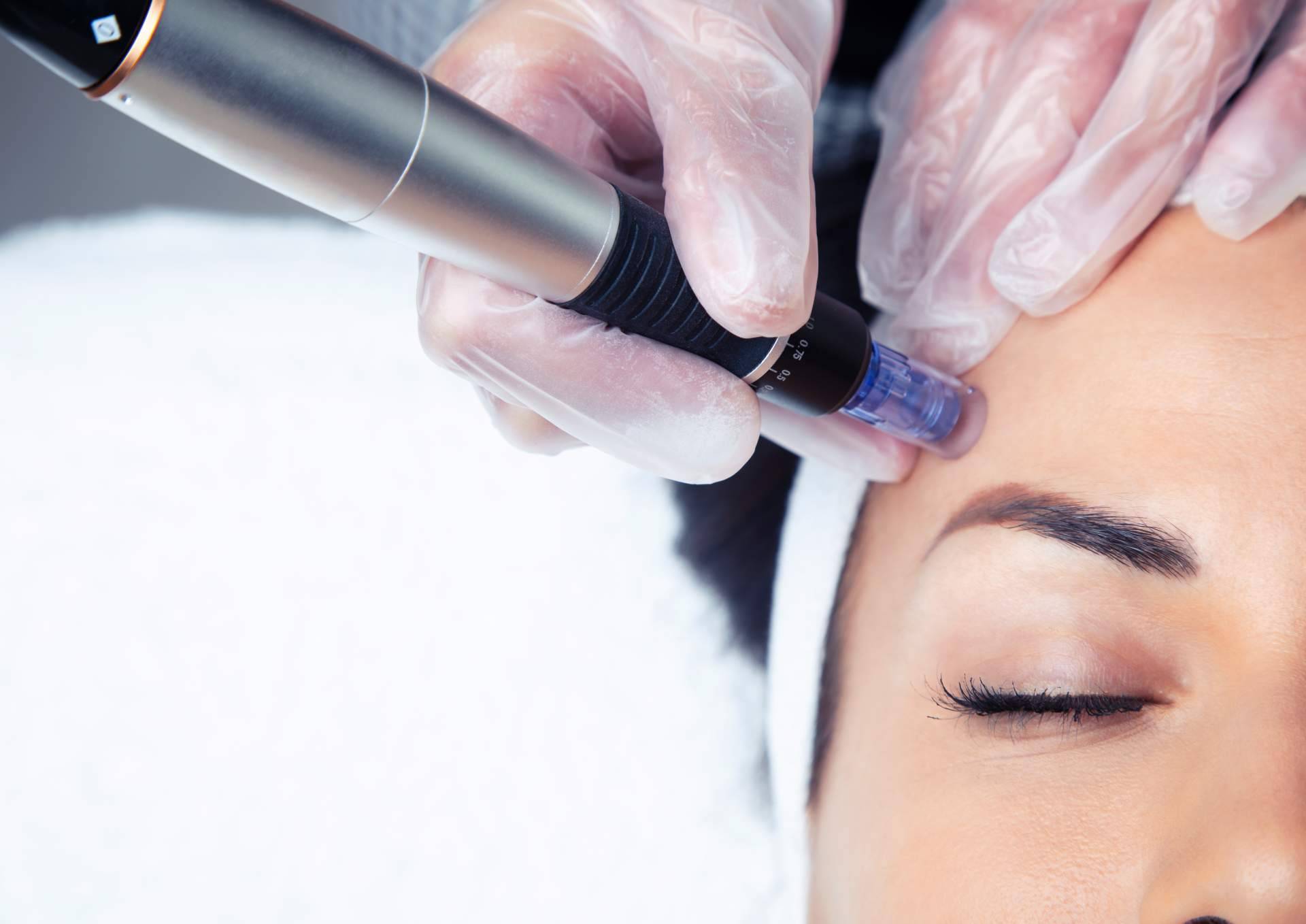 El impacto de la primavera en la piel y los tratamientos faciales recomendados