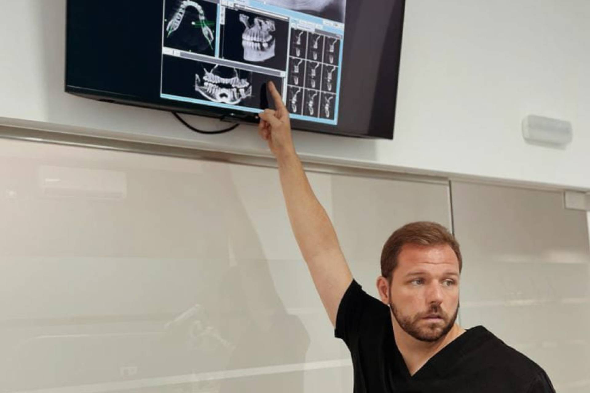 Implantes dentales fijos en un día; así avanza la rehabilitación oral digital en BR Dental Móstoles